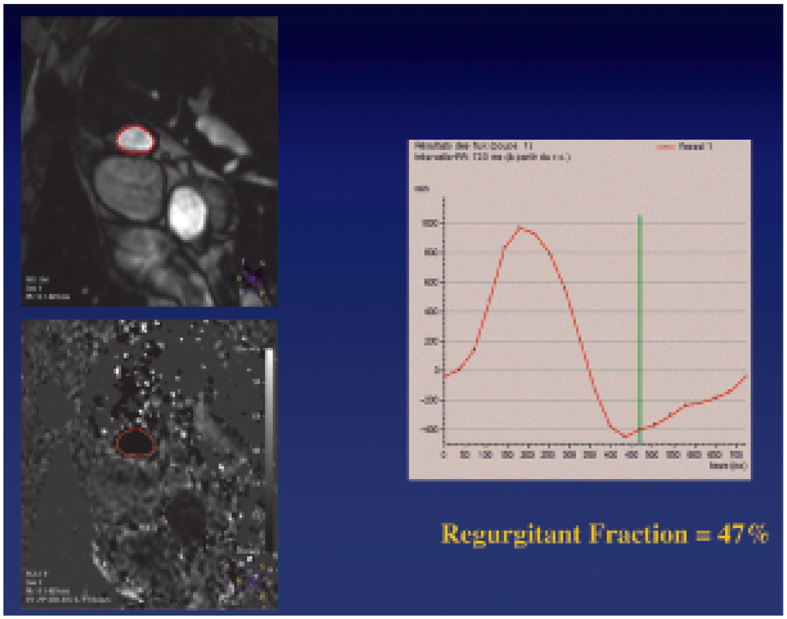 Cardiovascmed 09 00376 g001