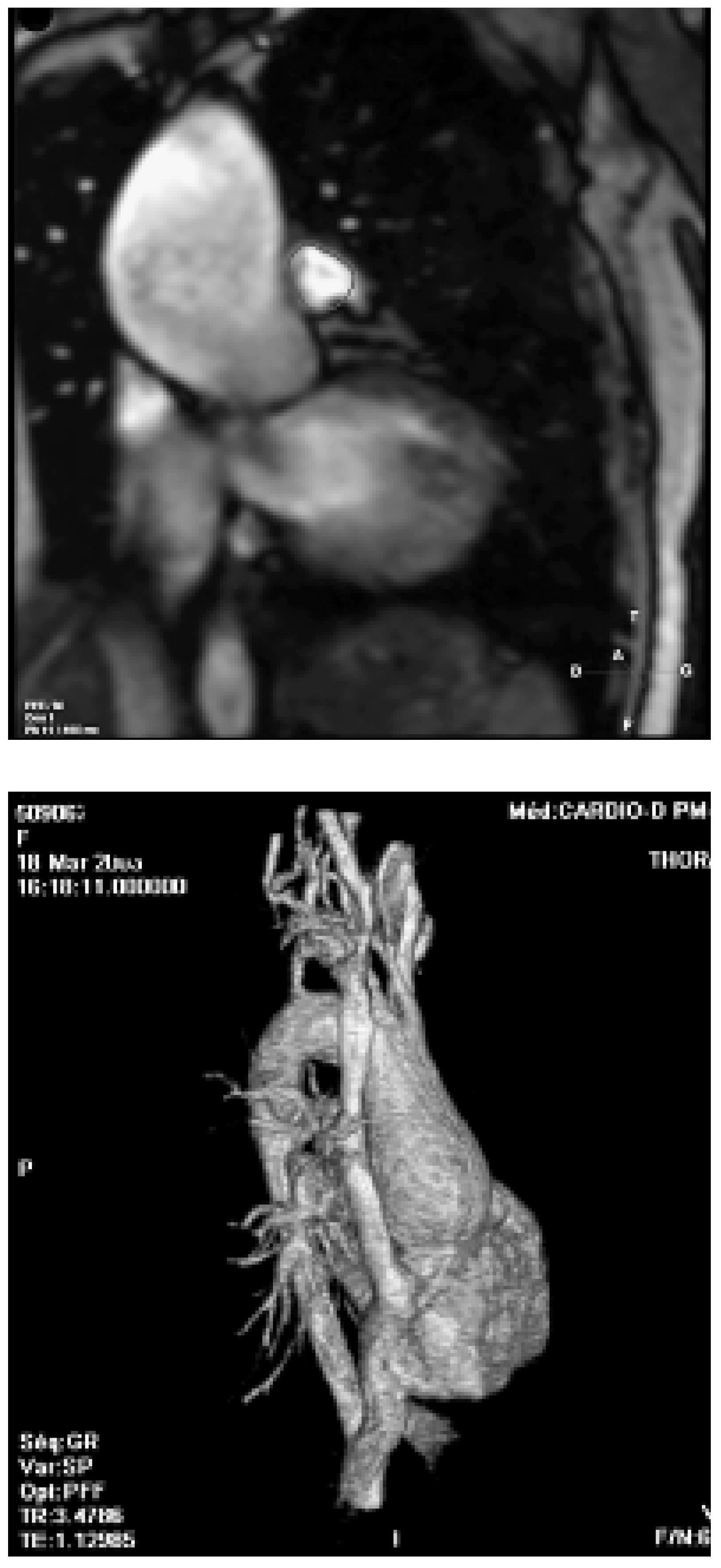 Cardiovascmed 09 00376 g003