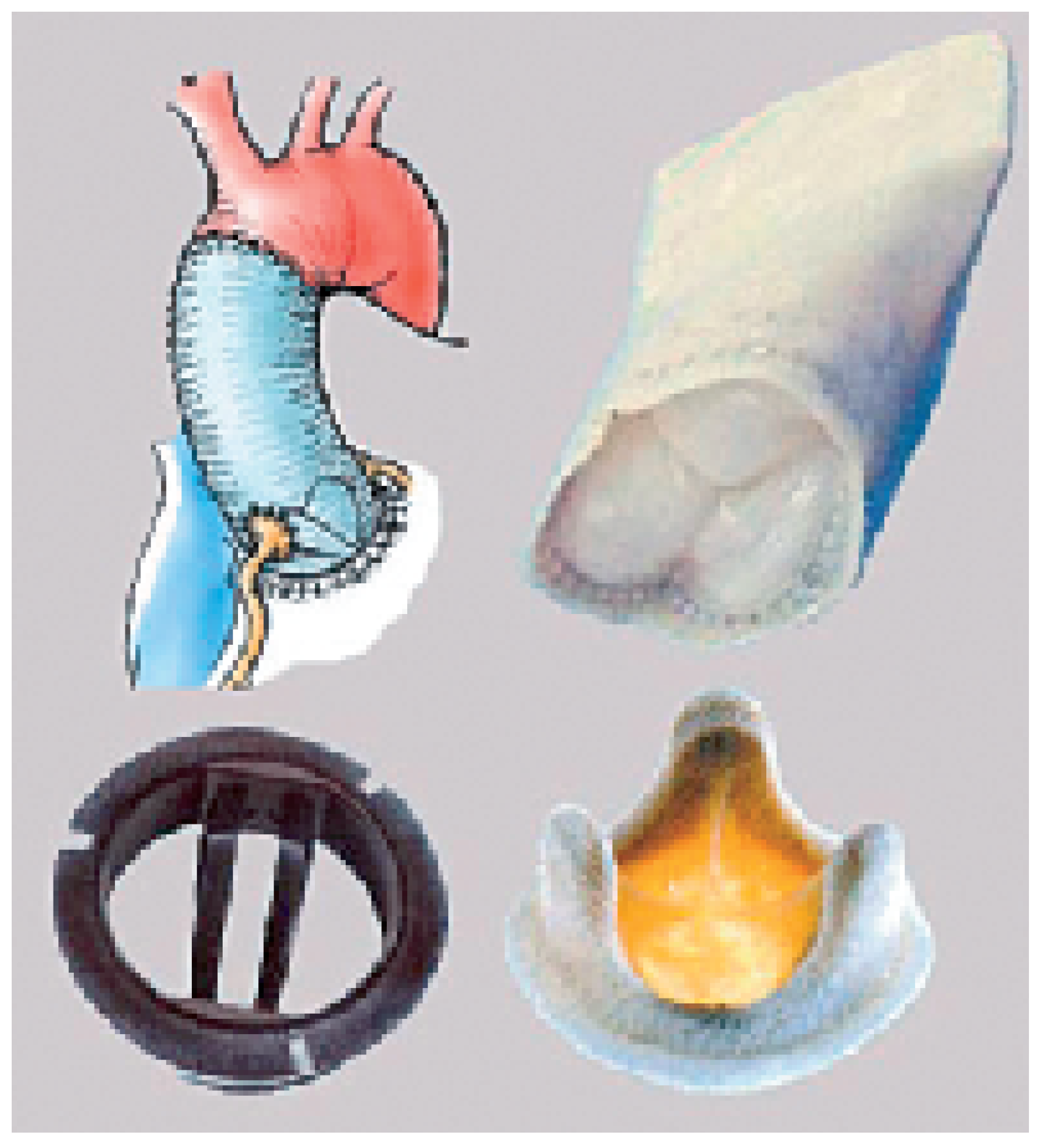 Cardiovascmed 09 00393 g001