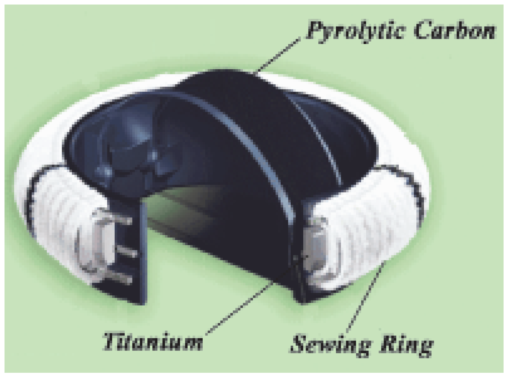Cardiovascmed 09 00393 g002