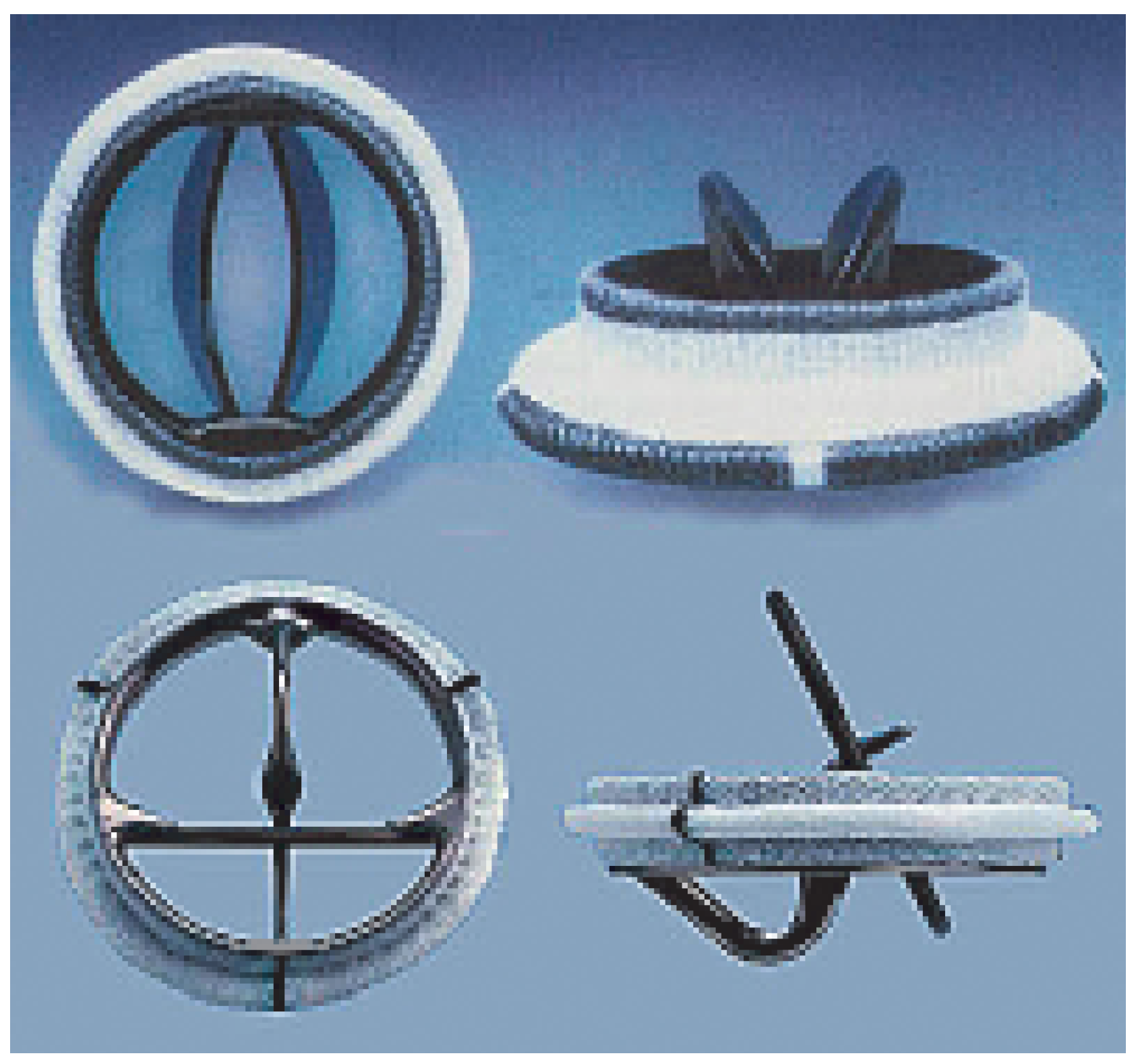 Cardiovascmed 09 00393 g003