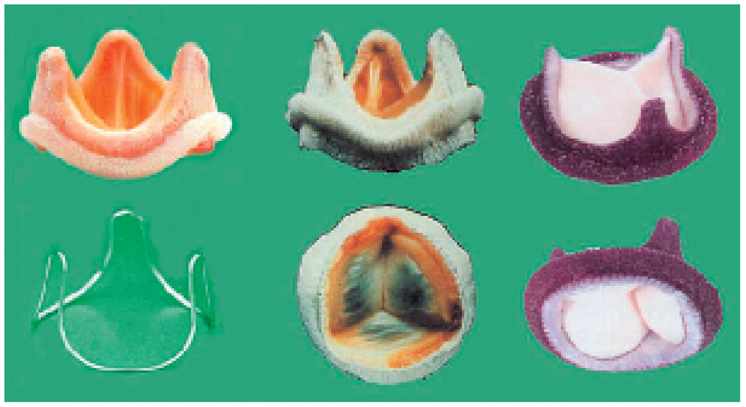 Cardiovascmed 09 00393 g004