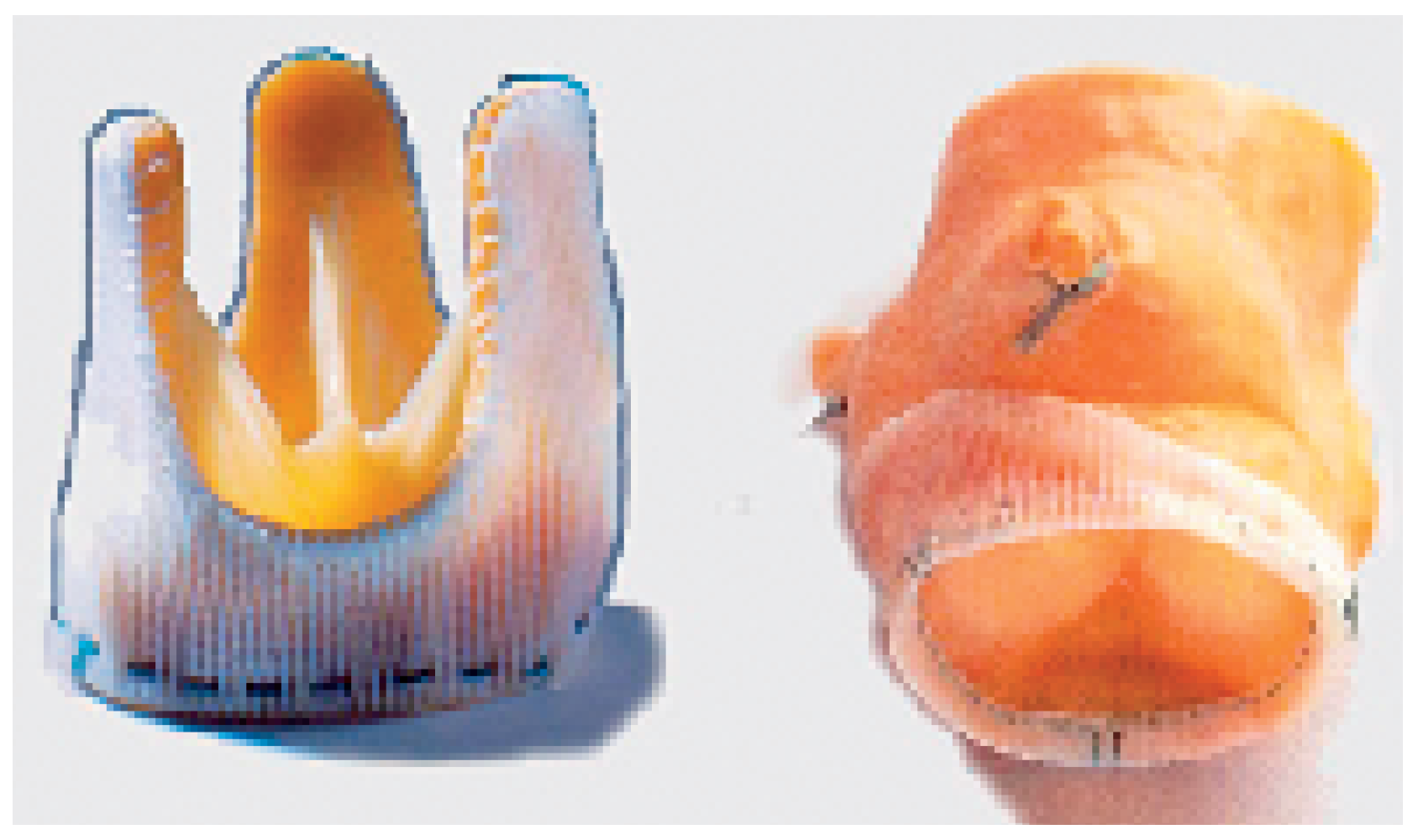 Cardiovascmed 09 00393 g005