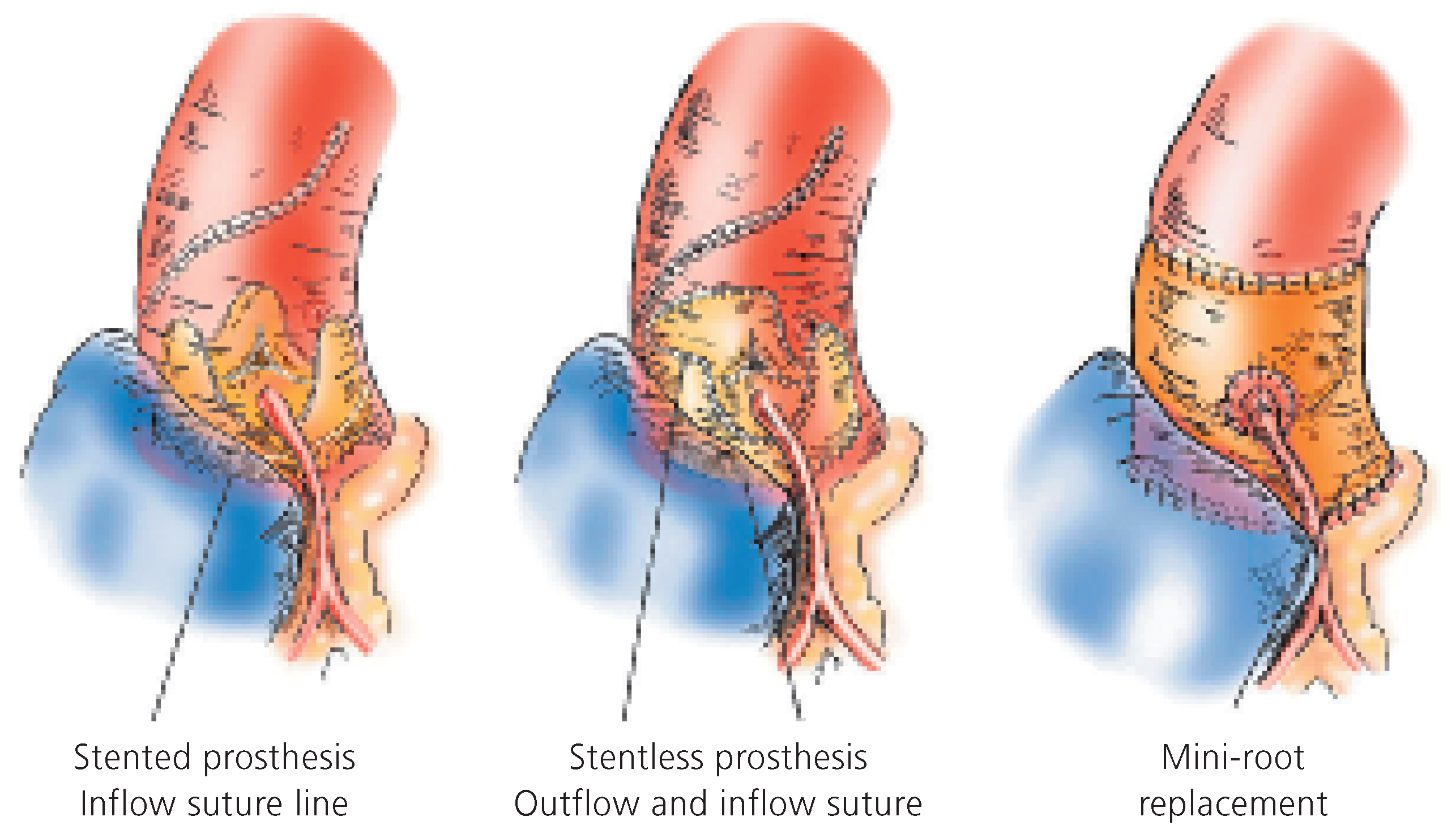 Cardiovascmed 09 00393 g006