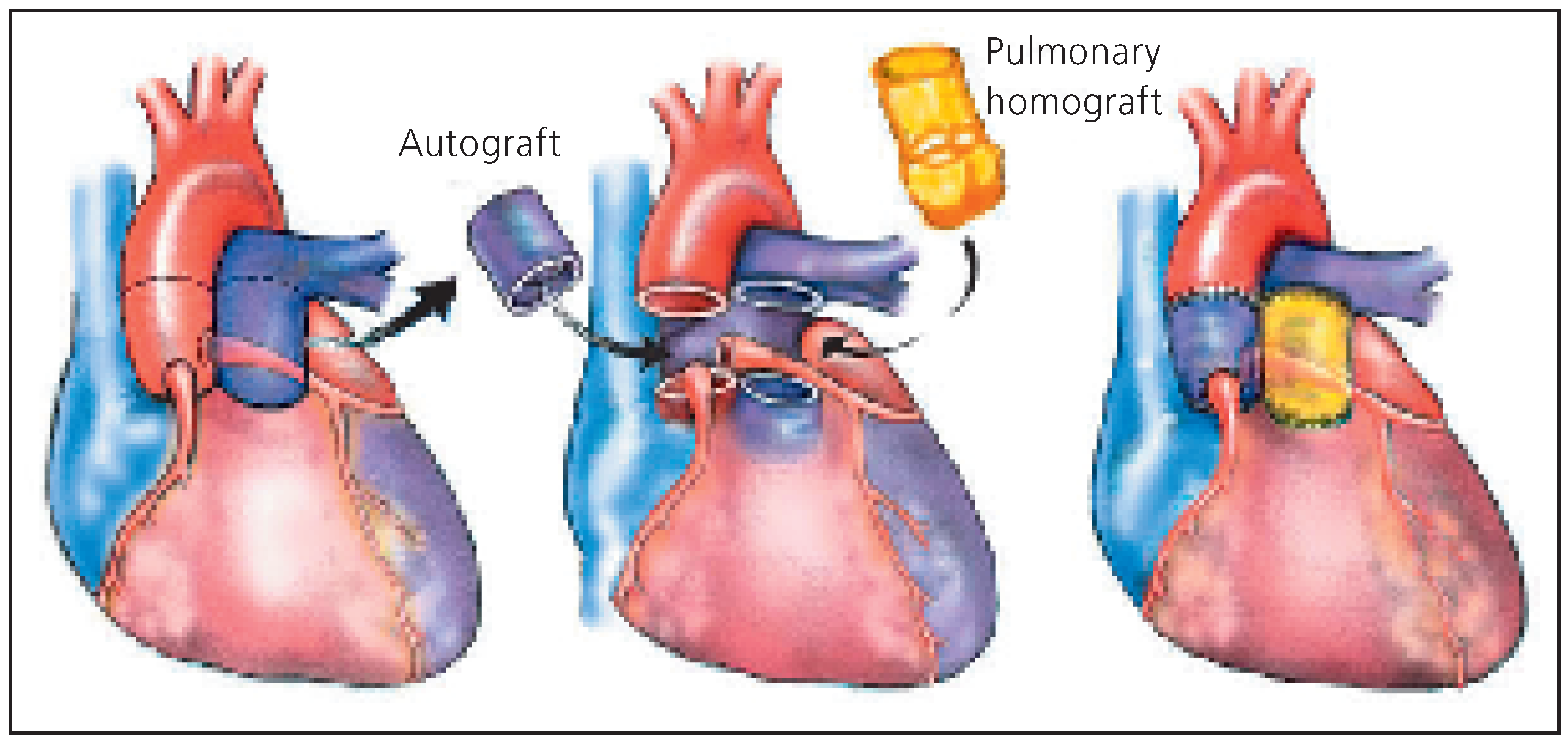 Cardiovascmed 09 00393 g007