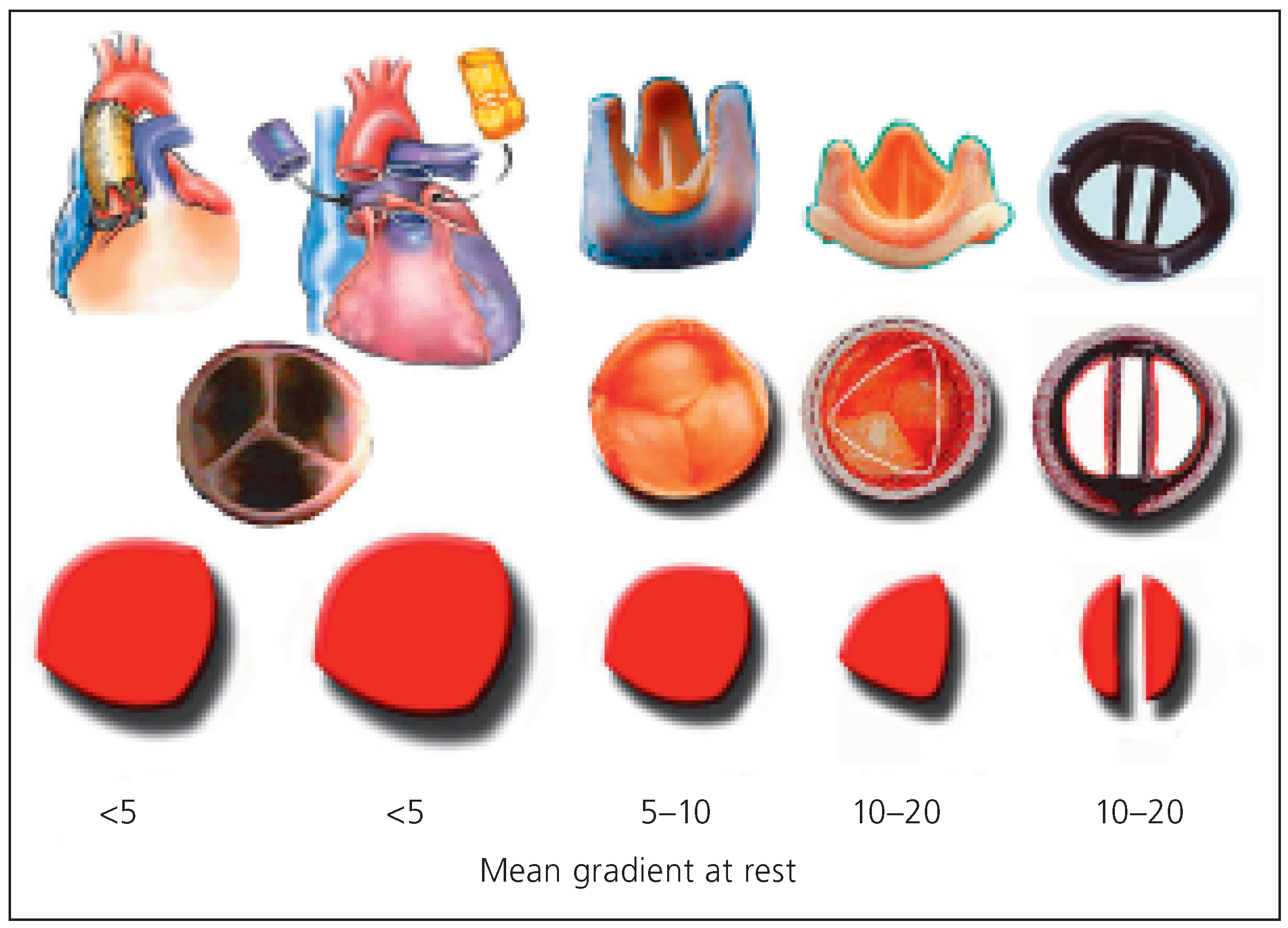 Cardiovascmed 09 00393 g009