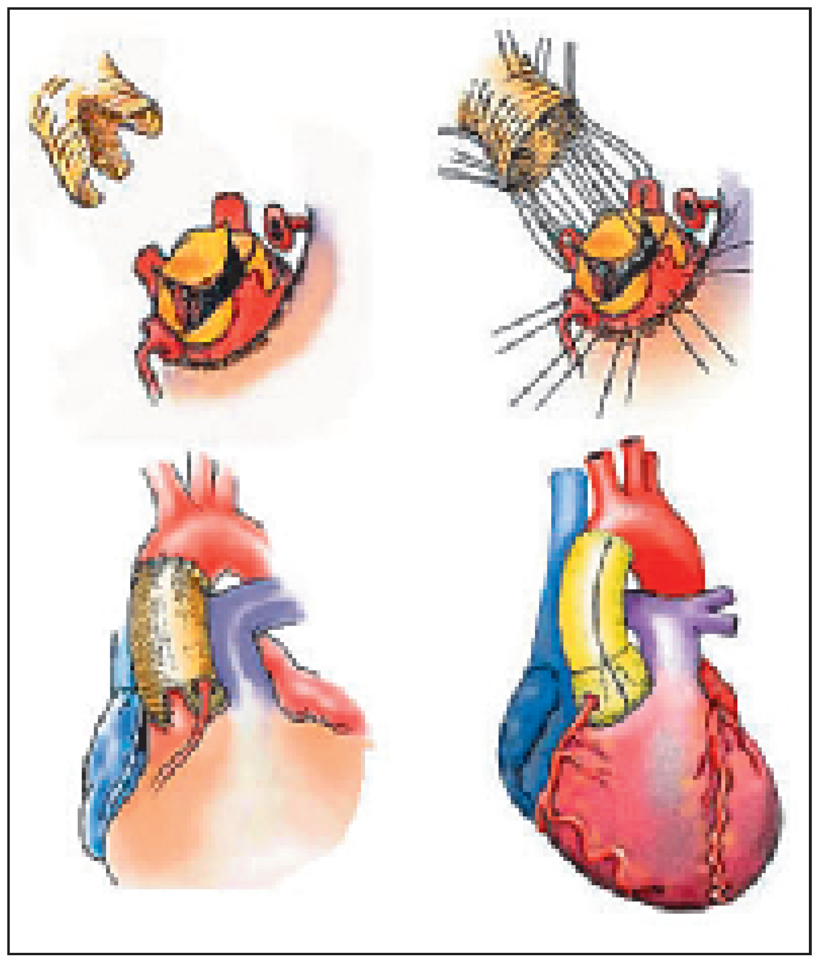 Cardiovascmed 09 00393 g010