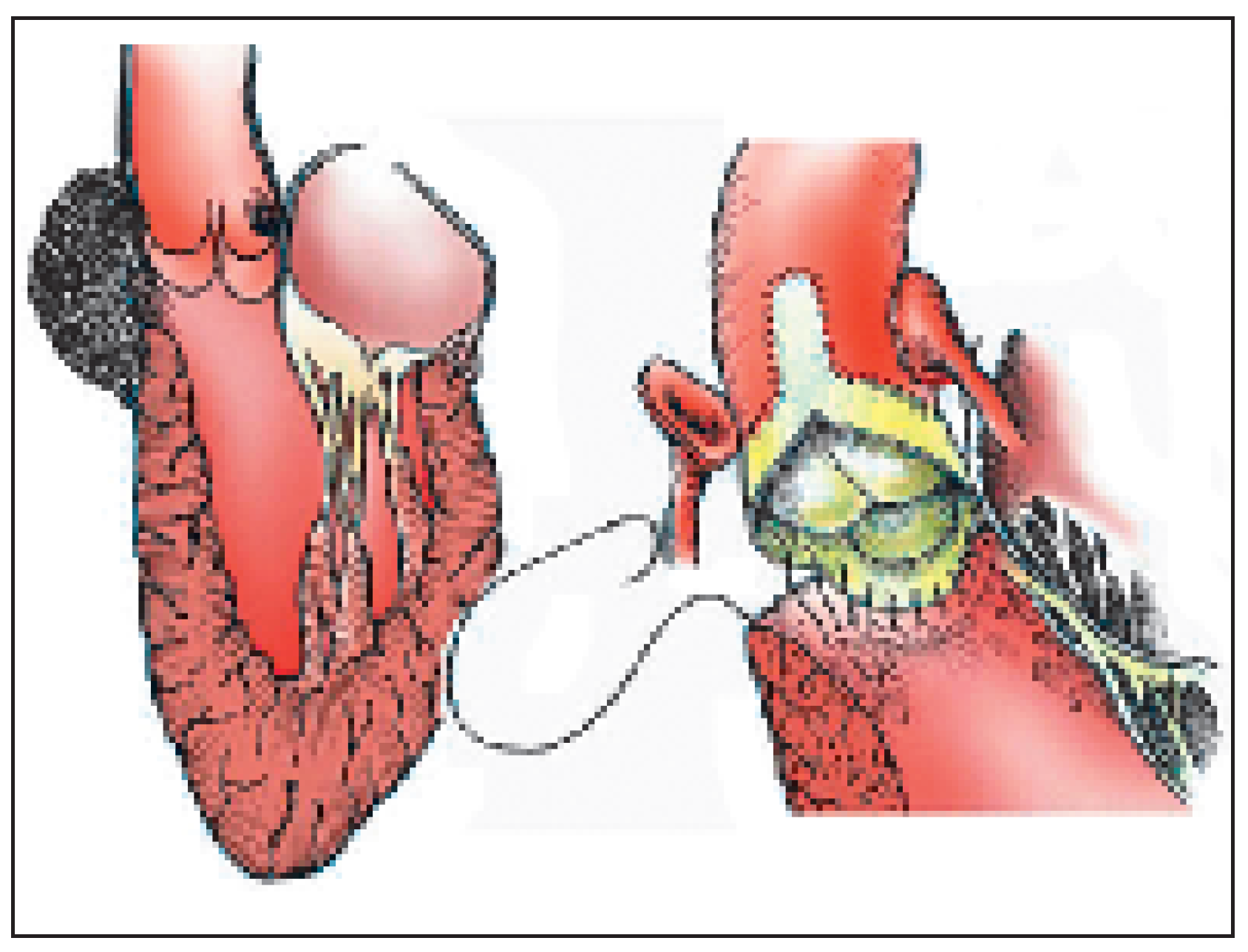 Cardiovascmed 09 00393 g011