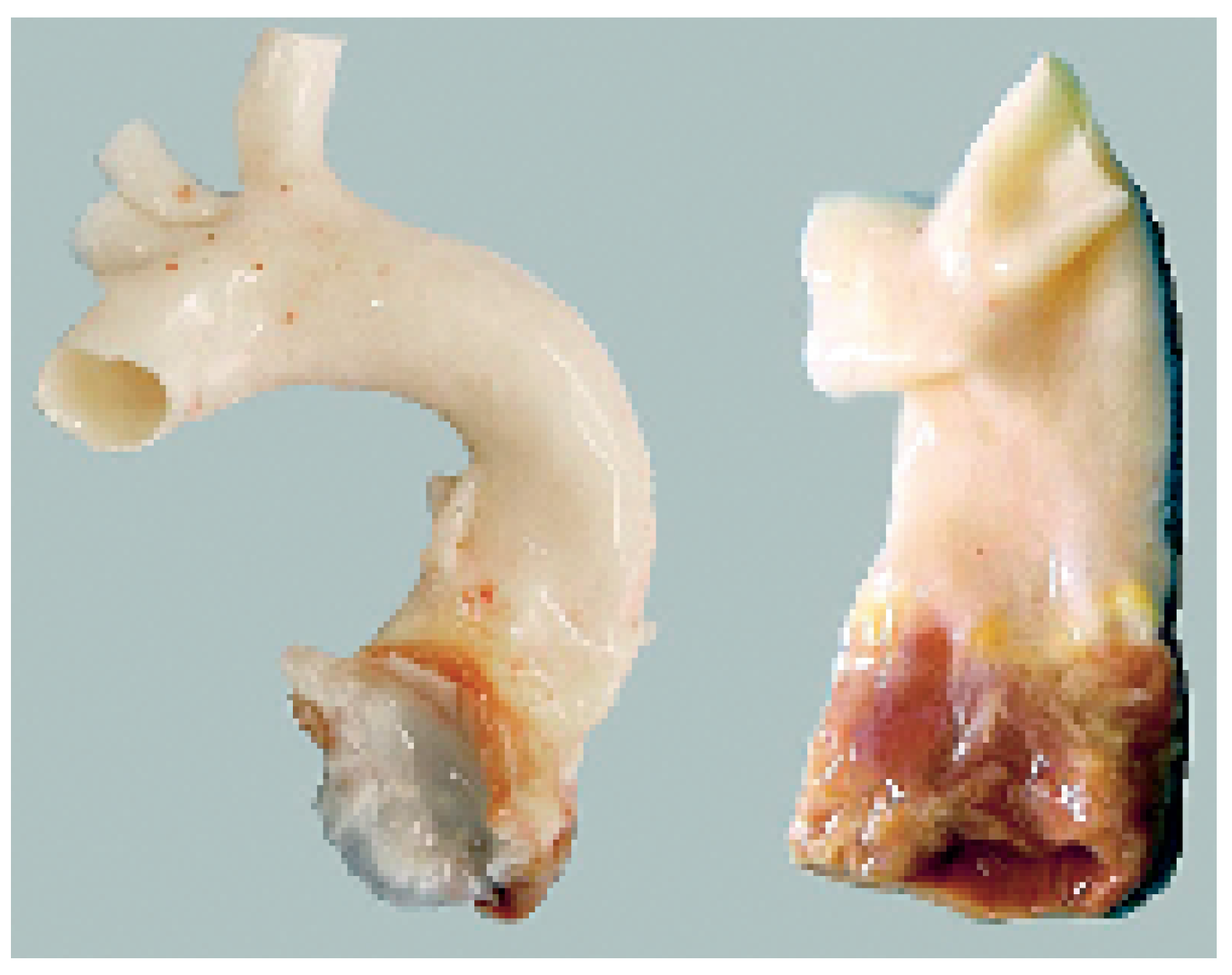 Cardiovascmed 09 00393 g013