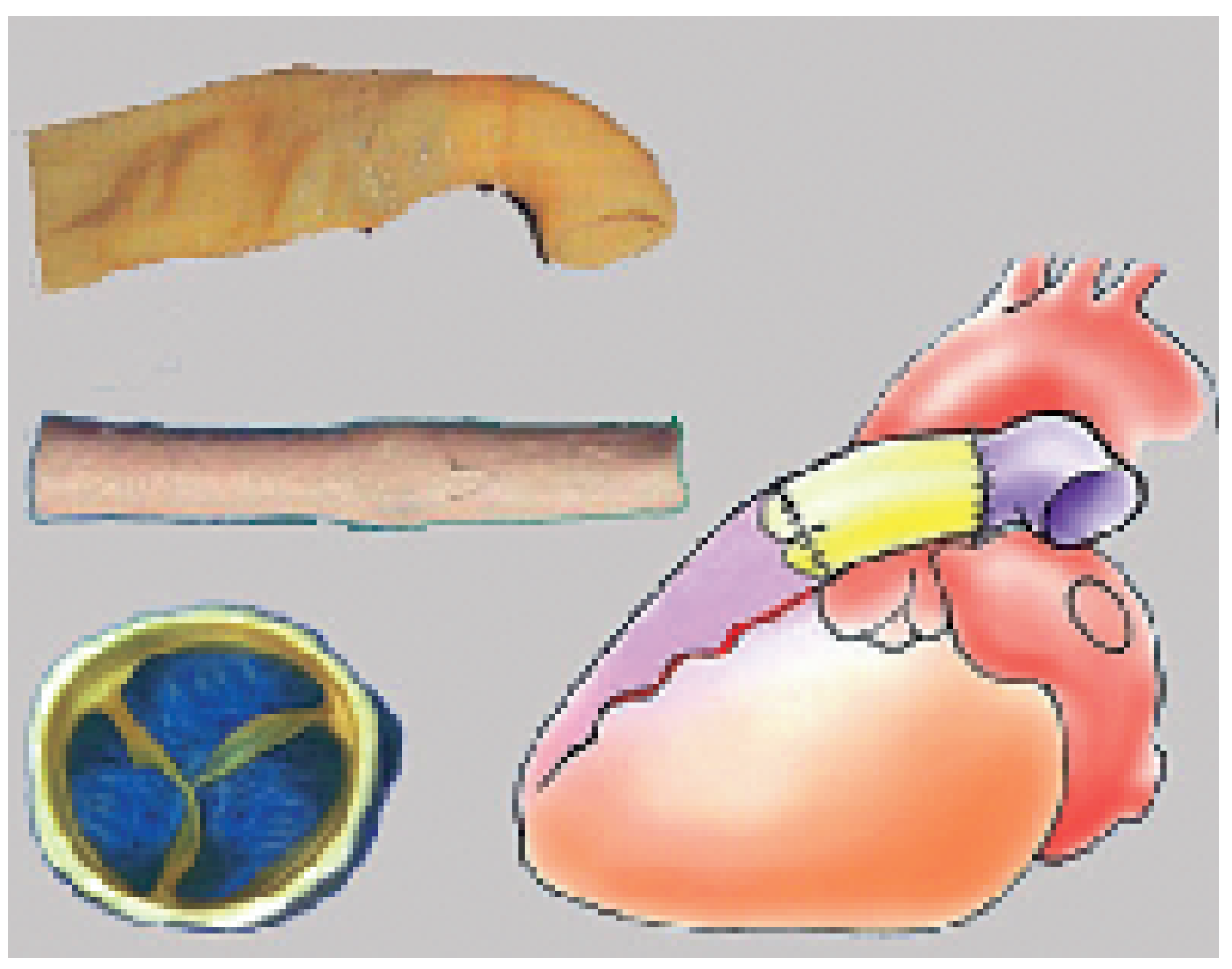 Cardiovascmed 09 00393 g014