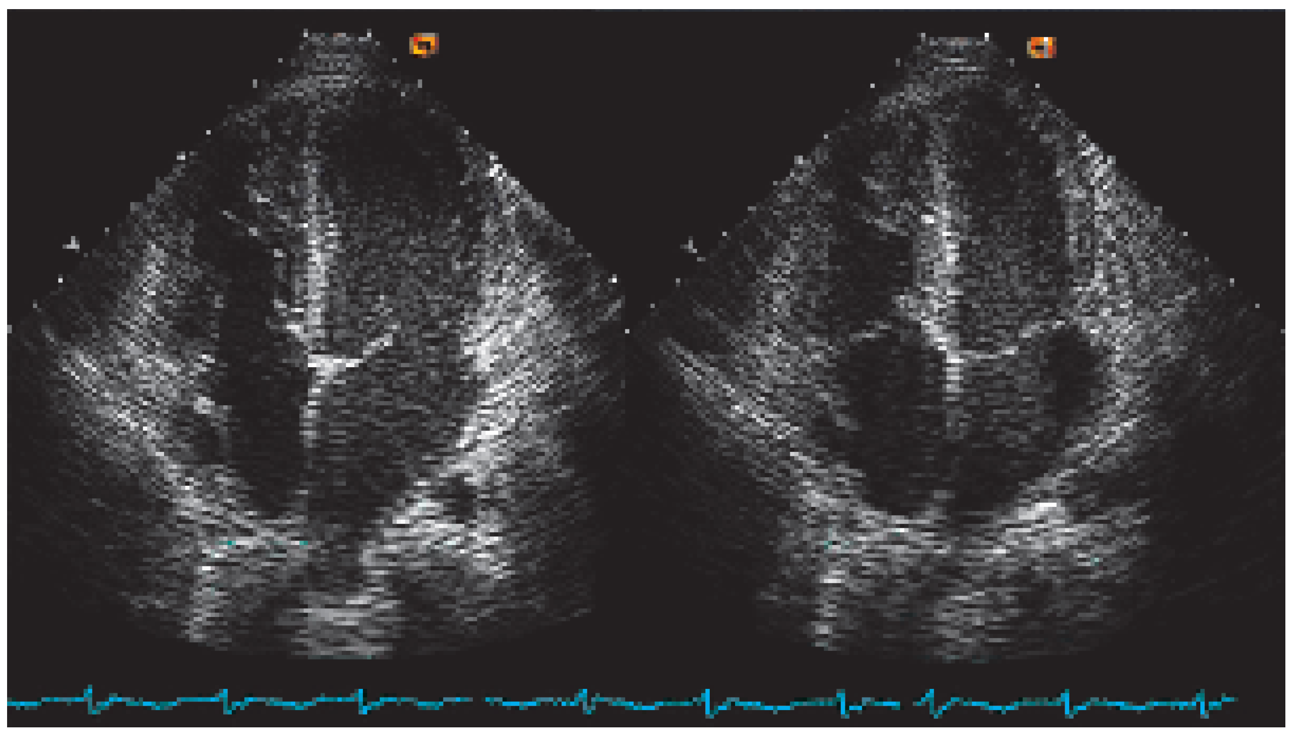 Cardiovascmed 09 00393 g015