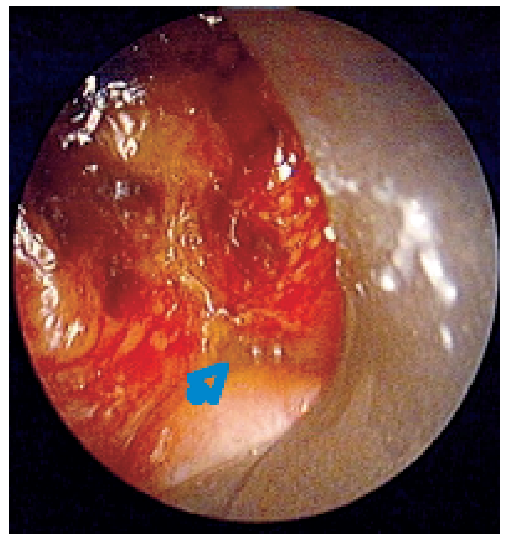 Cardiovascmed 10 00101 g001
