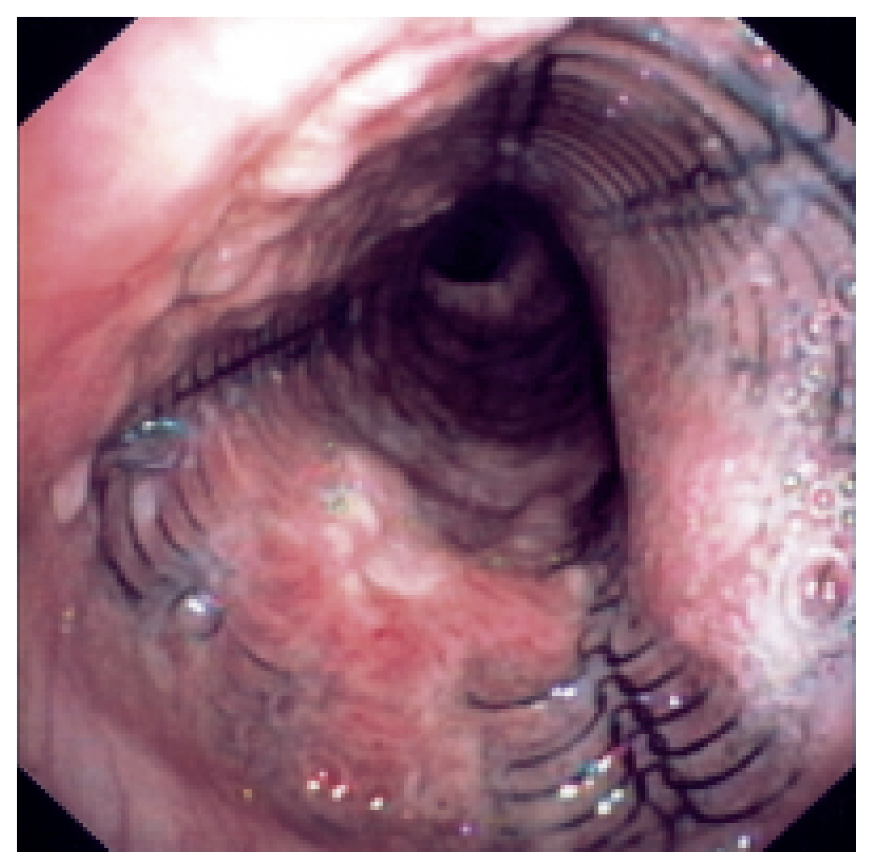 Cardiovascmed 10 00101 g006