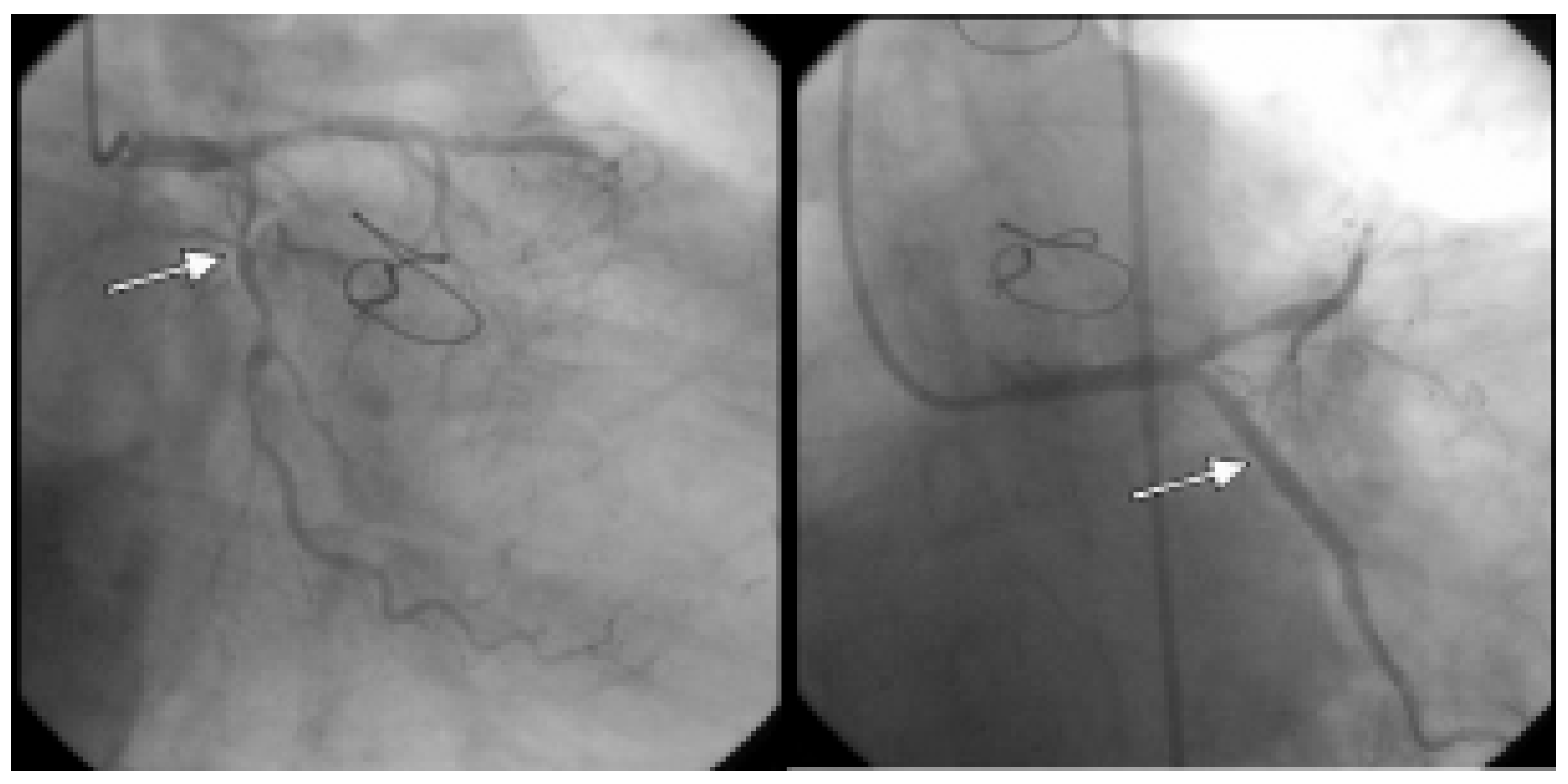 Cardiovascmed 10 00108 g001