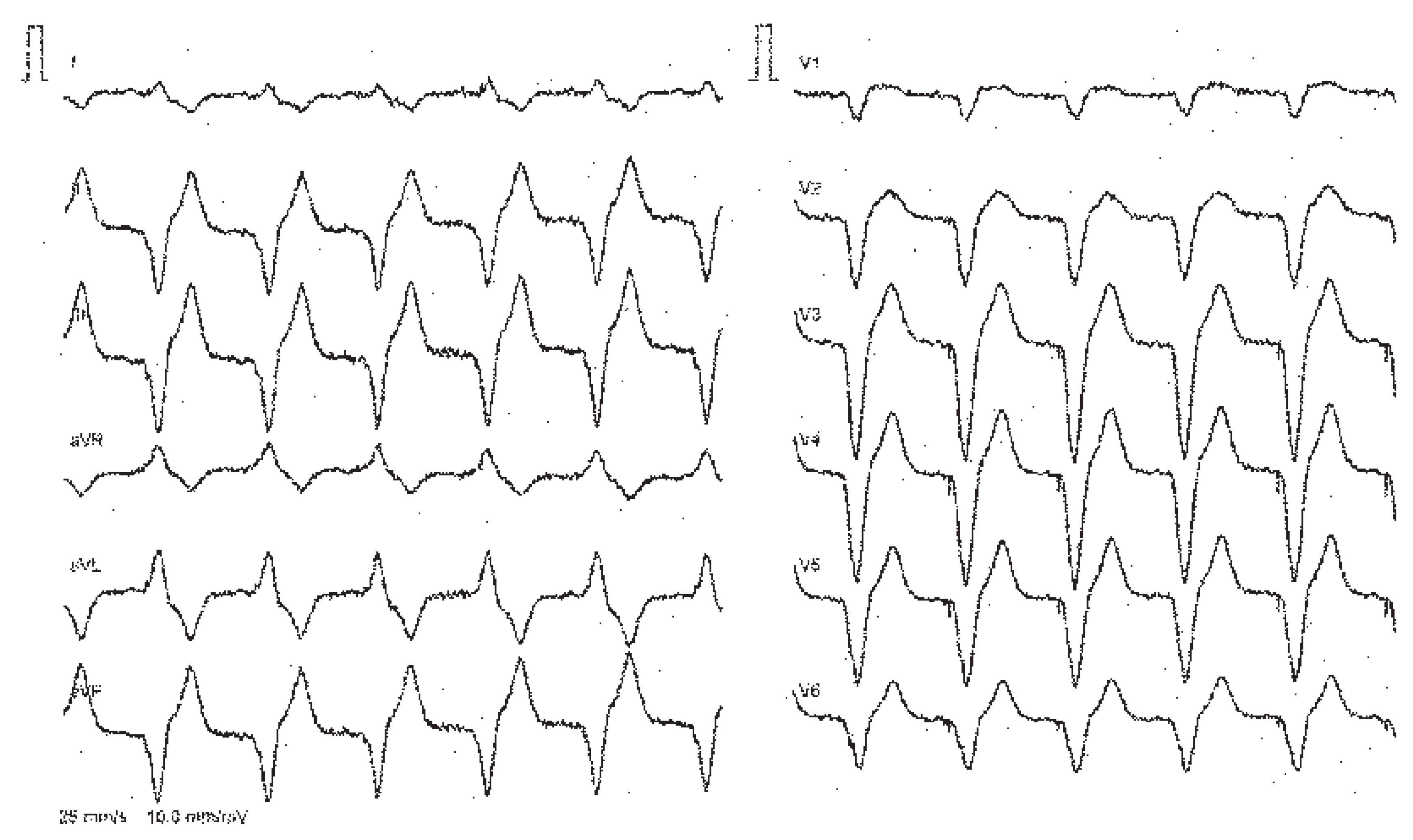 Cardiovascmed 10 00111 g001 Cardiovascmed 10 00111 g001