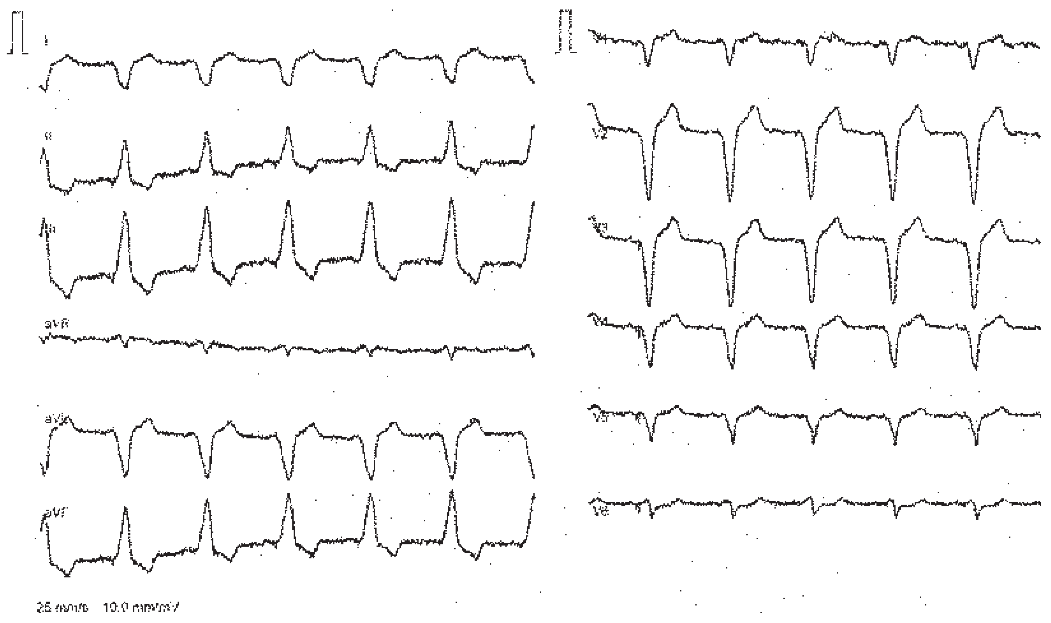 Cardiovascmed 10 00111 g002 Cardiovascmed 10 00111 g002