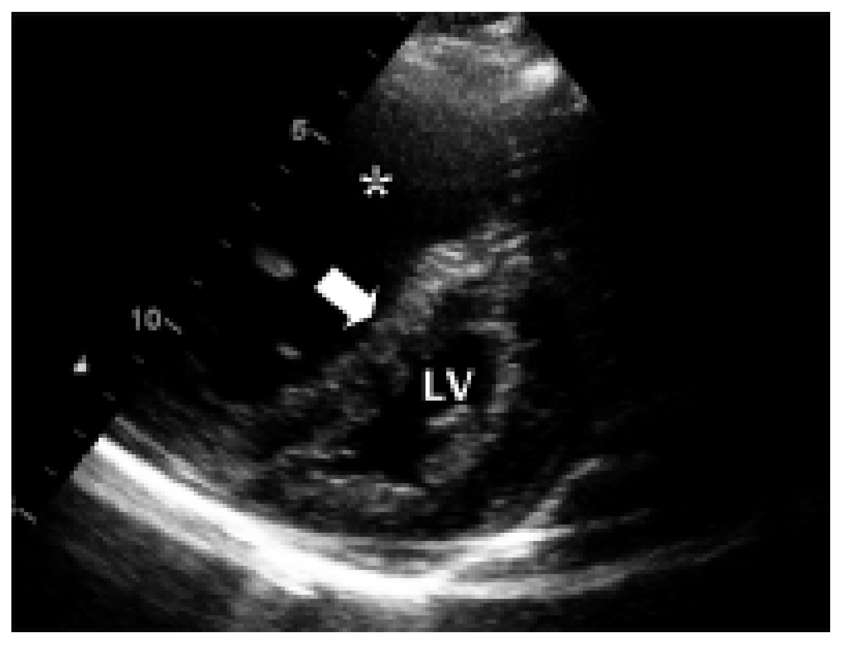 Cardiovascmed 10 00113 g003