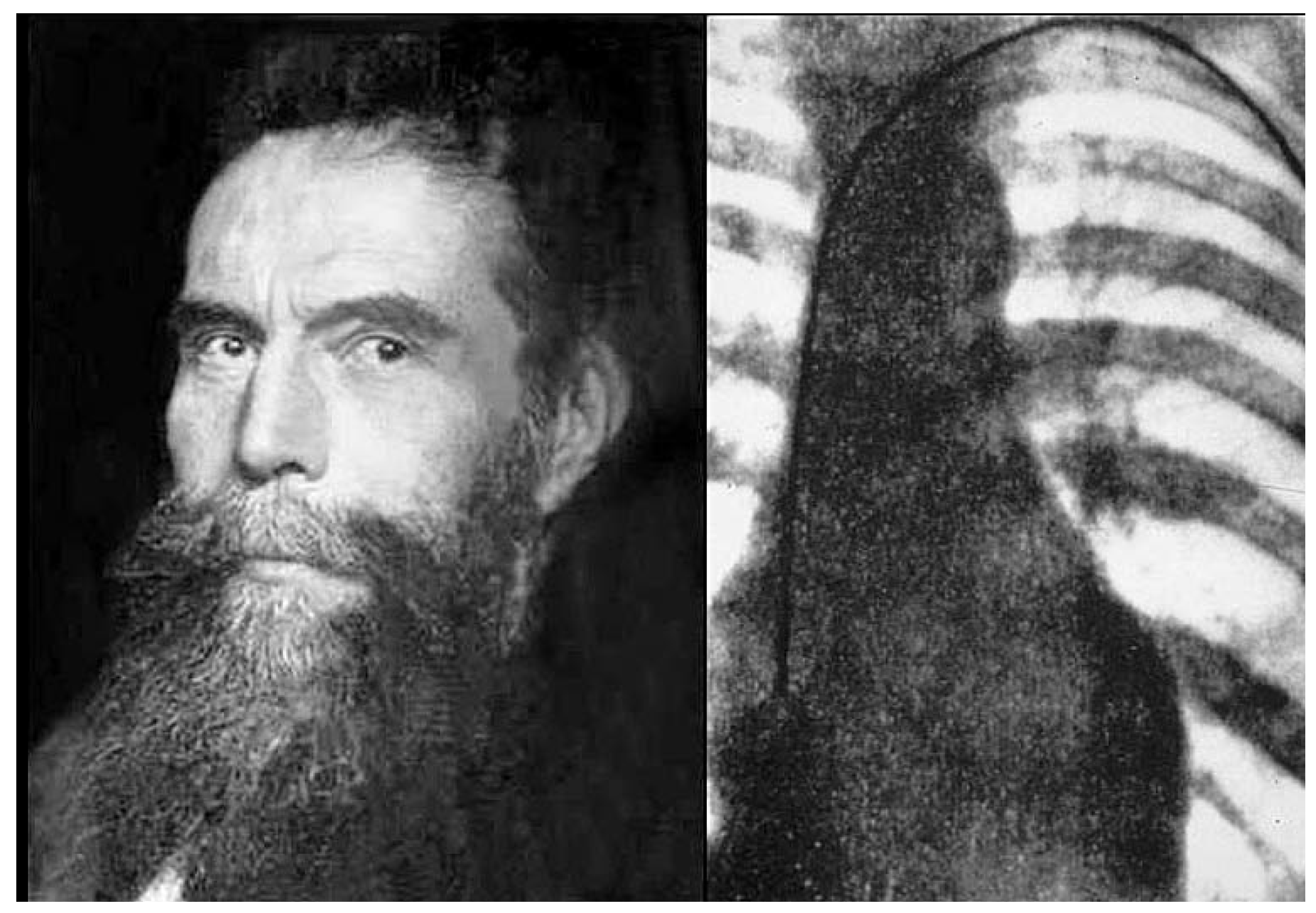 Cardiovascmed 10 00121 g001