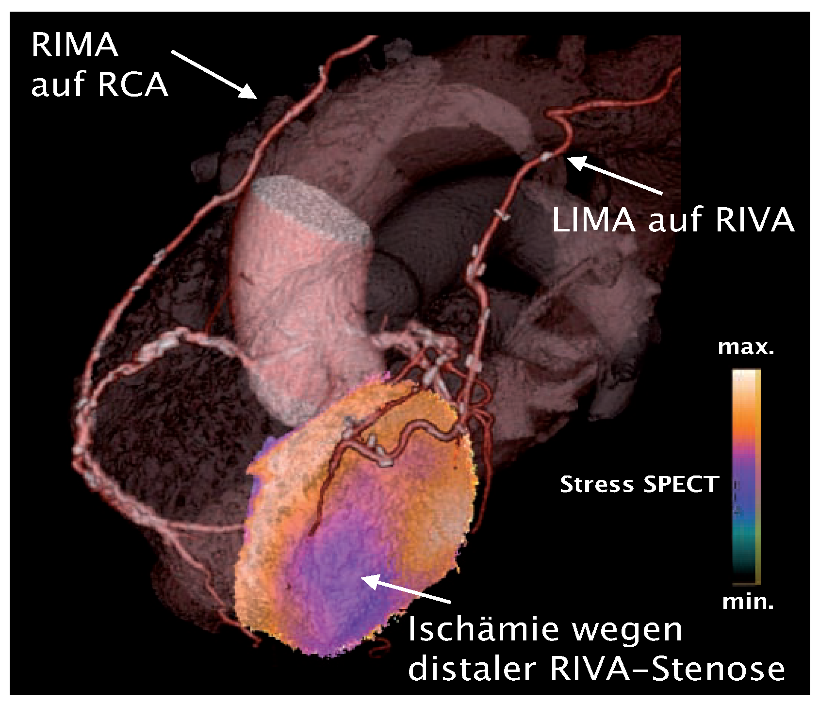 Cardiovascmed 10 00121 g002