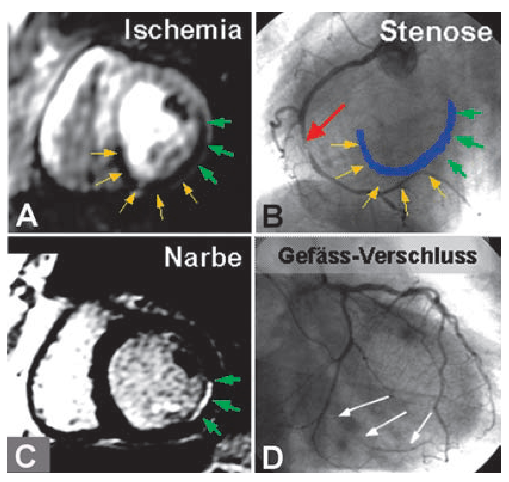 Cardiovascmed 10 00126 g005
