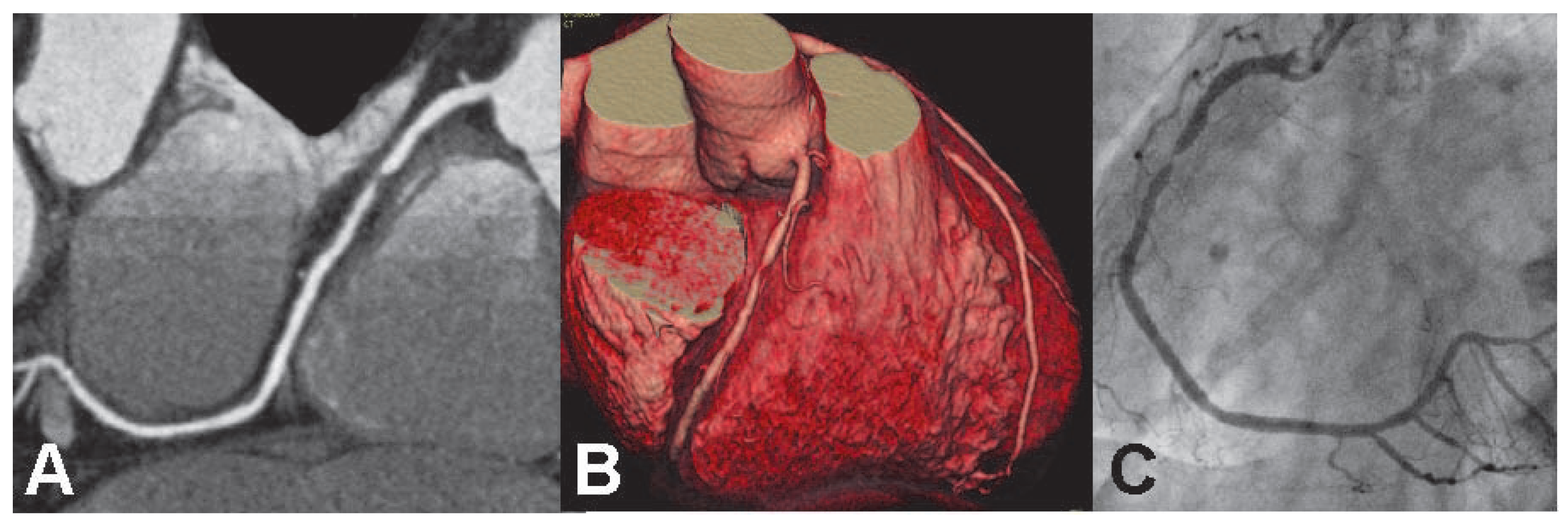 Cardiovascmed 10 00126 g007