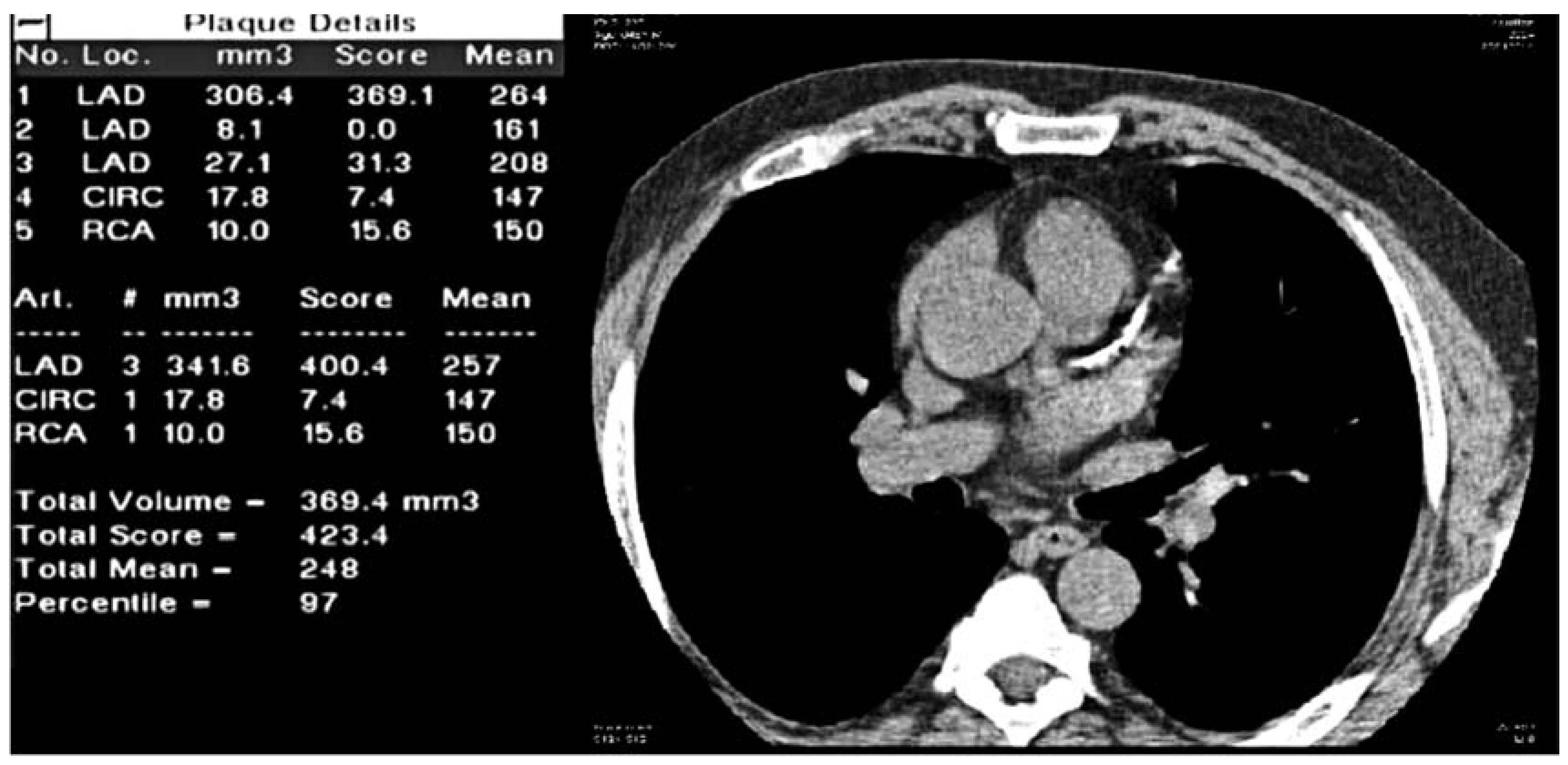 Cardiovascmed 10 00139 g003