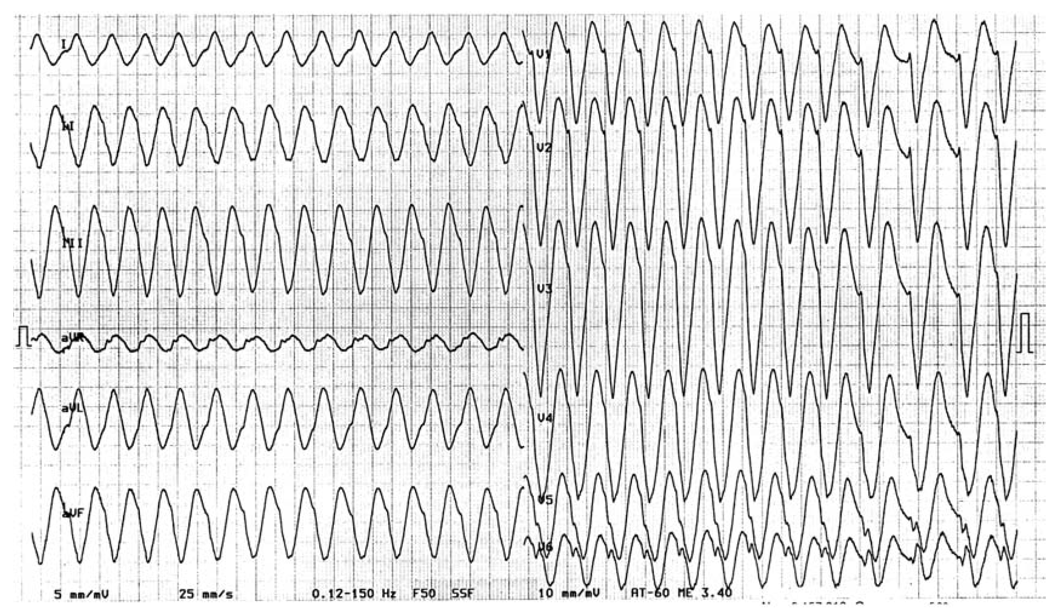 Cardiovascmed 10 00151 g001 Cardiovascmed 10 00151 g001