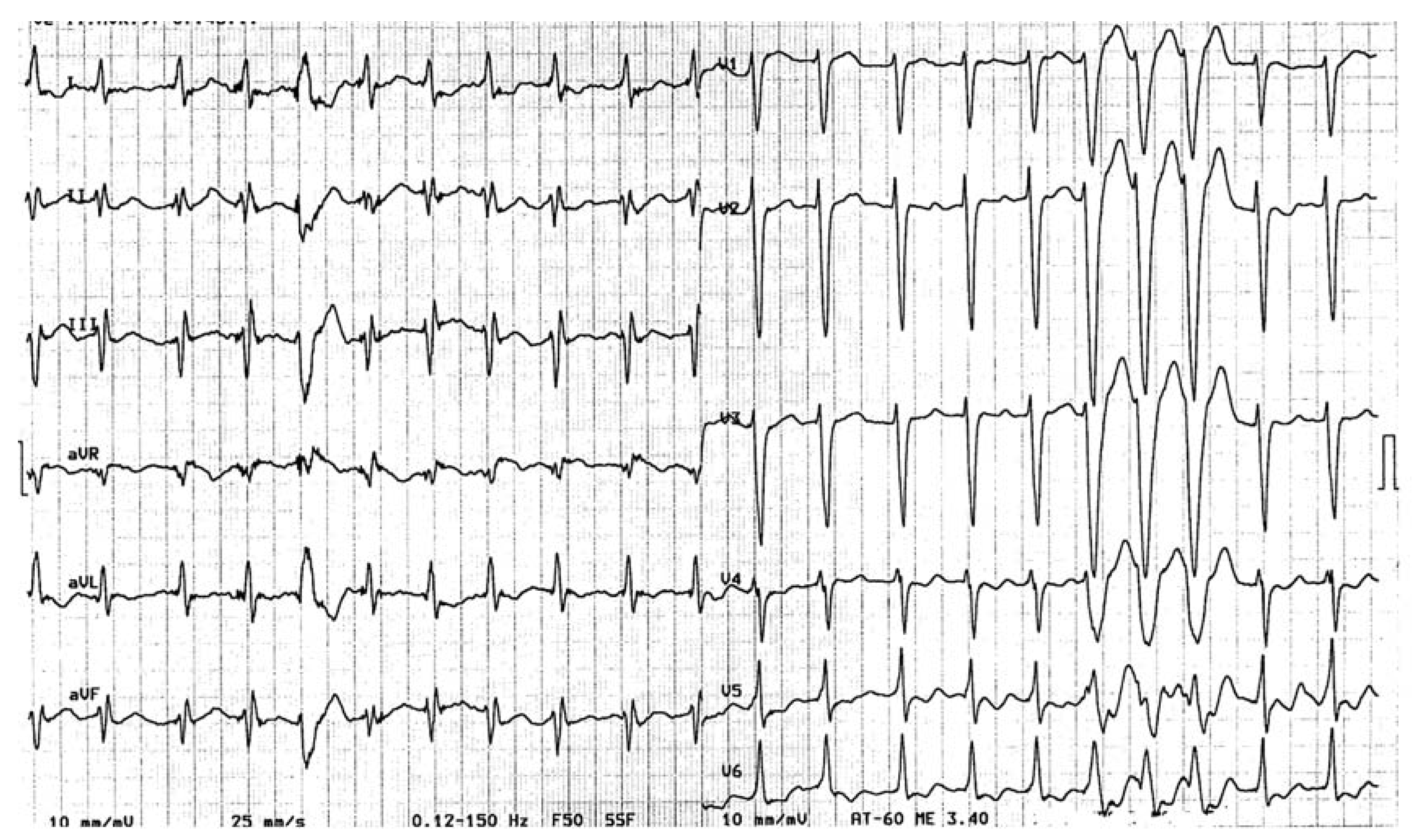 Cardiovascmed 10 00151 g002 Cardiovascmed 10 00151 g002