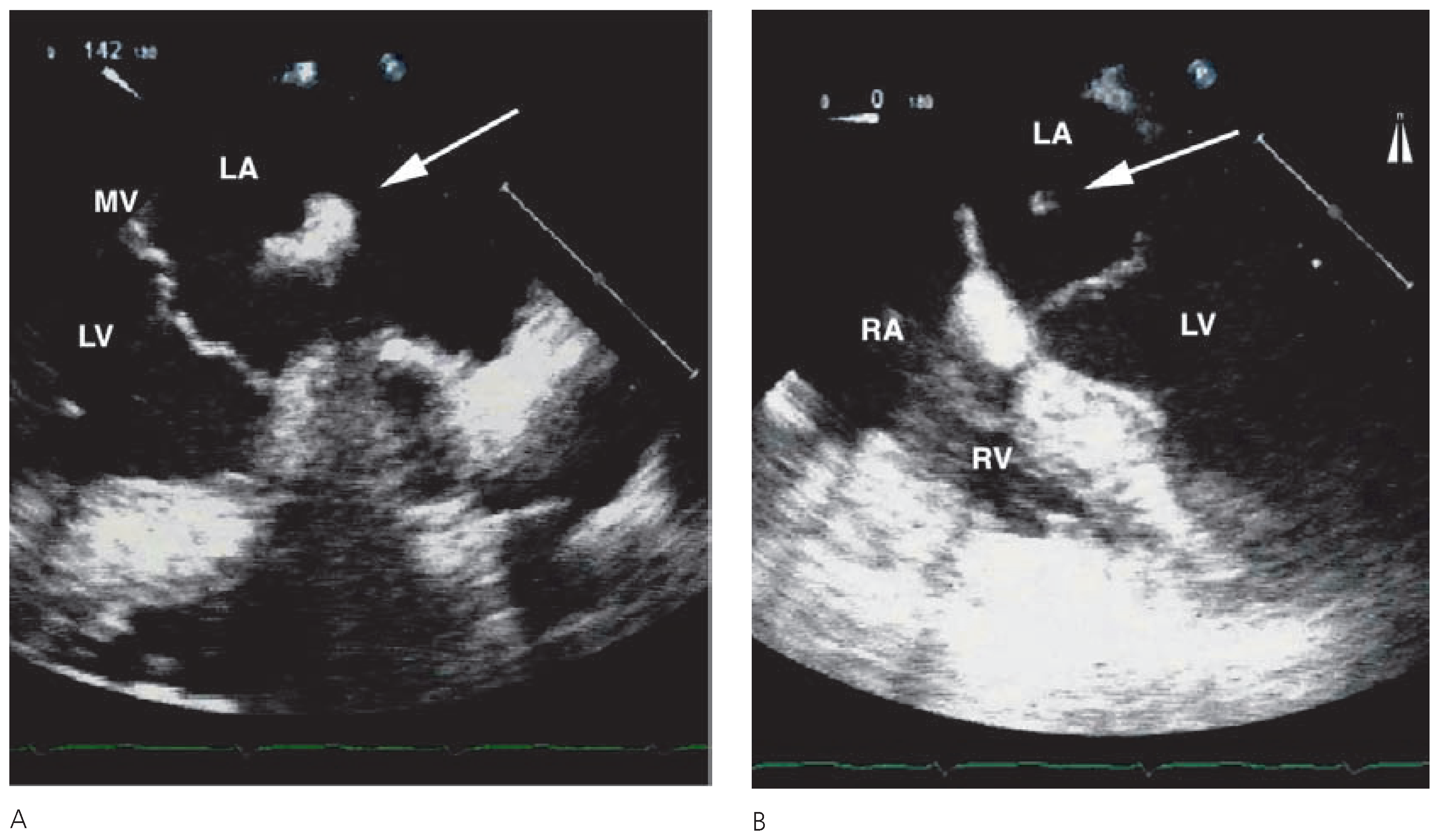 Cardiovascmed 10 00153 g001 Cardiovascmed 10 00153 g001