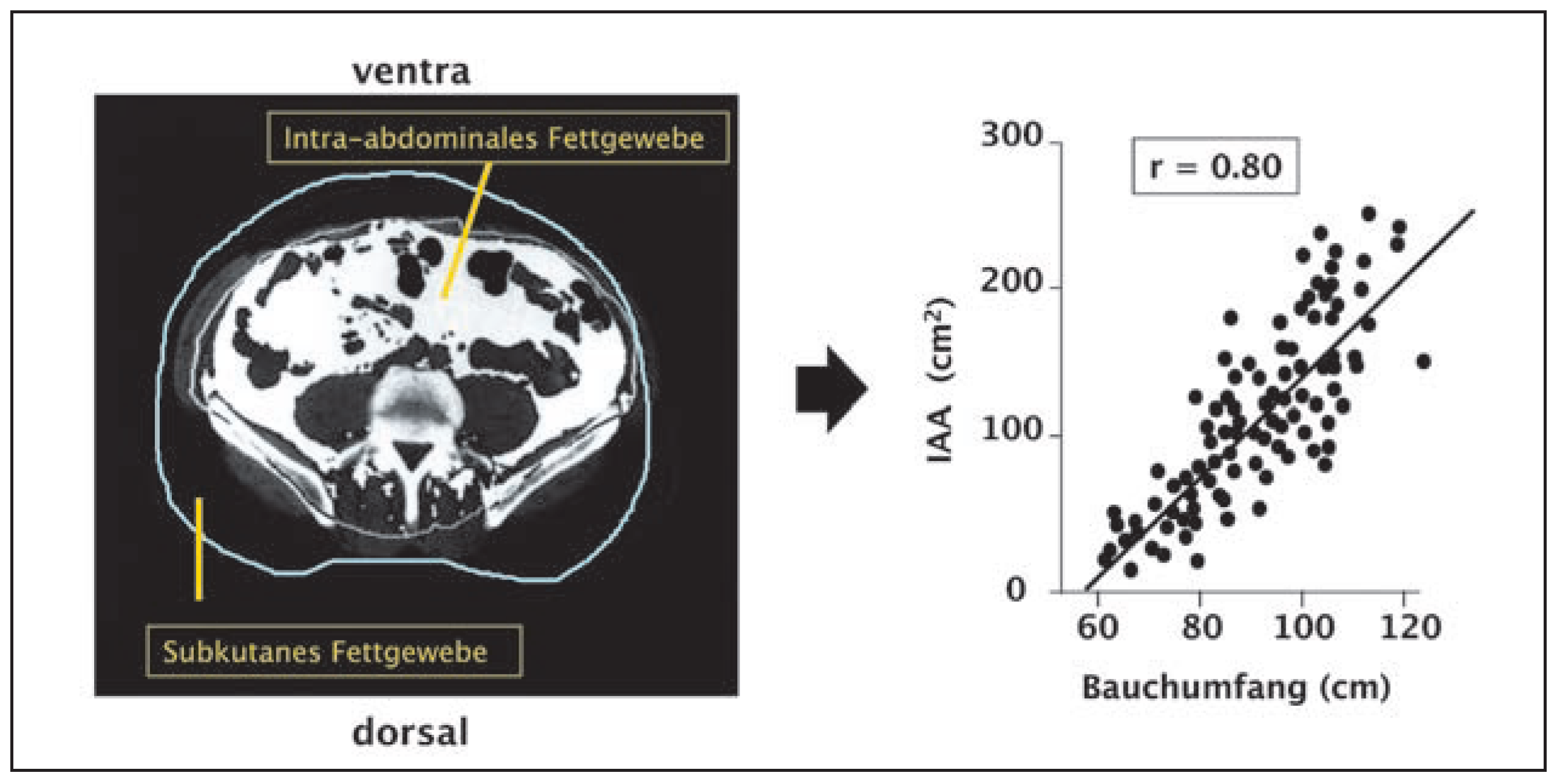 Cardiovascmed 10 00163 g003 Cardiovascmed 10 00163 g003