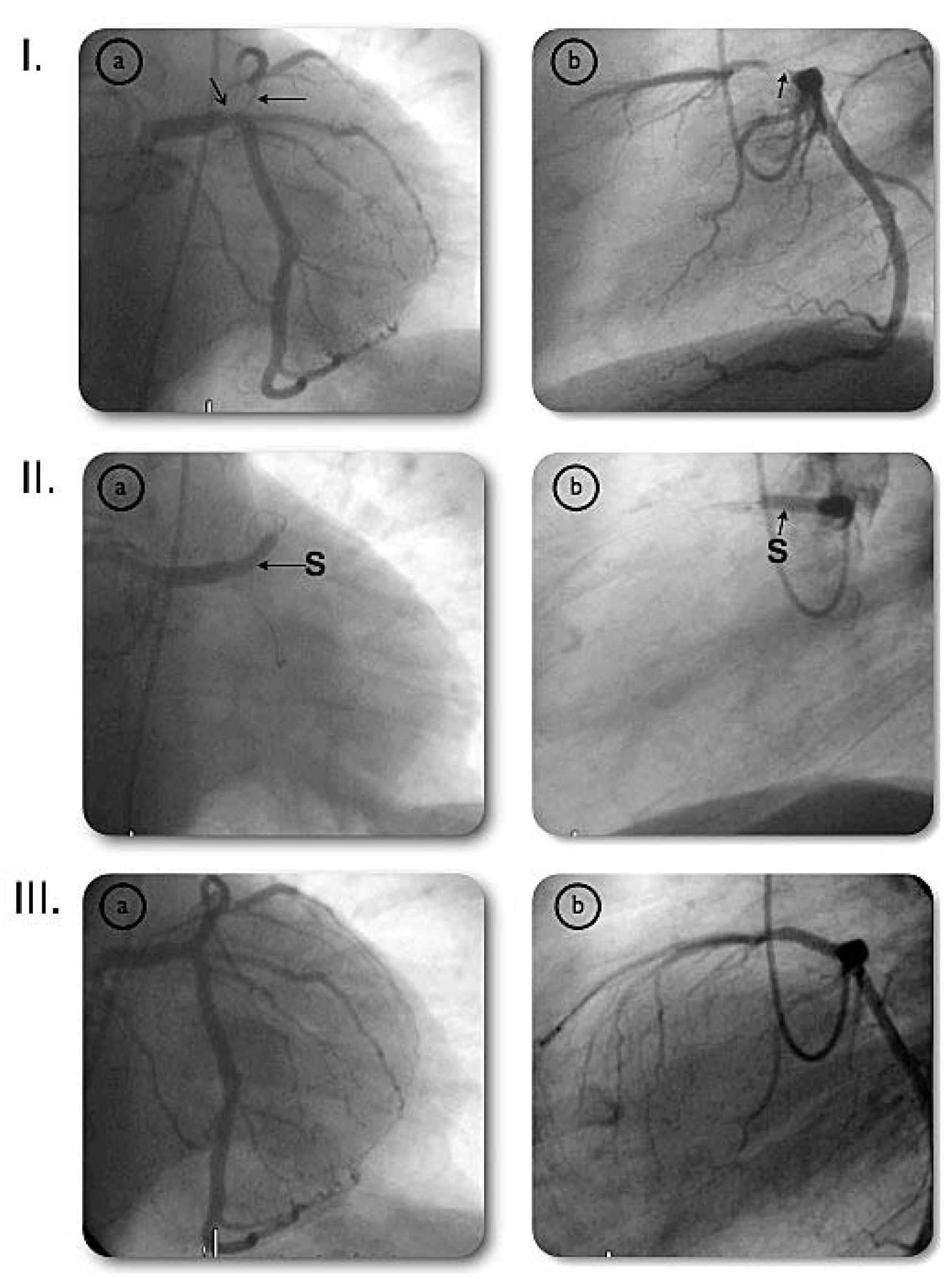 Cardiovascmed 10 00174 g001 Cardiovascmed 10 00174 g001