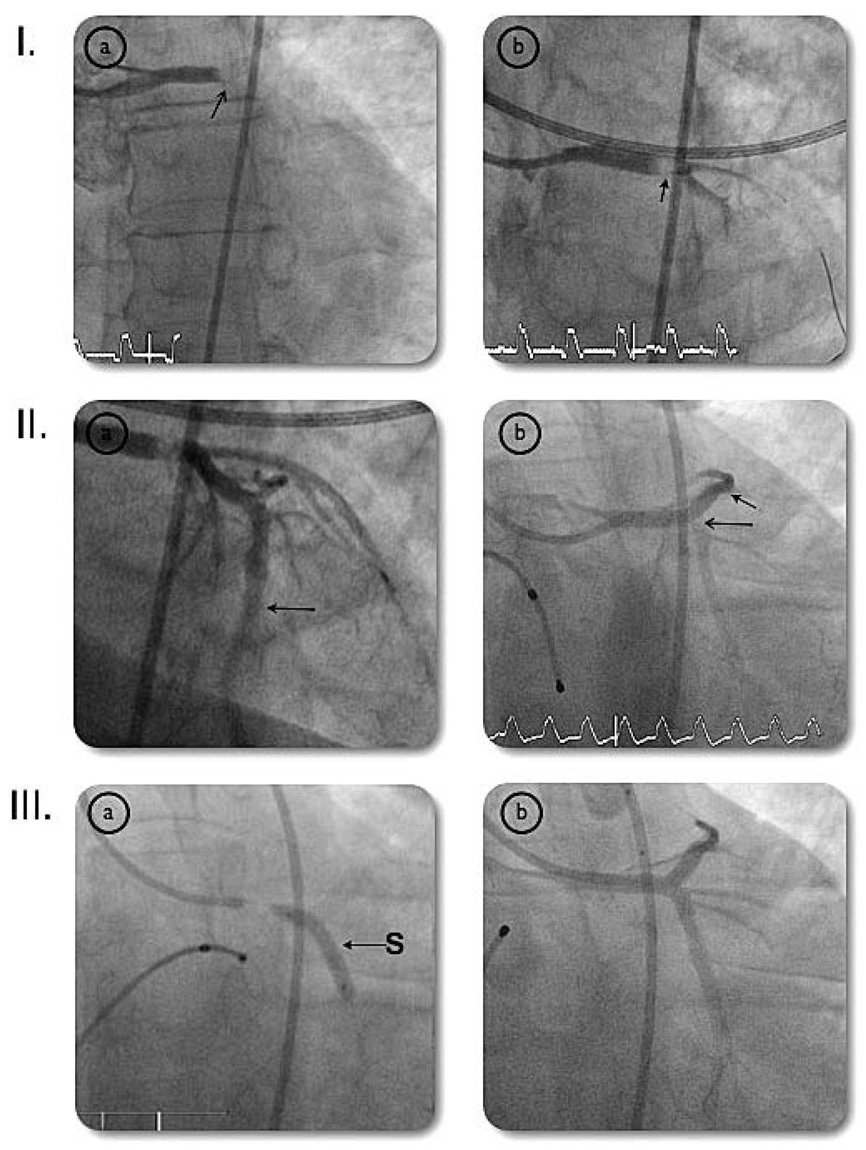 Cardiovascmed 10 00174 g002 Cardiovascmed 10 00174 g002