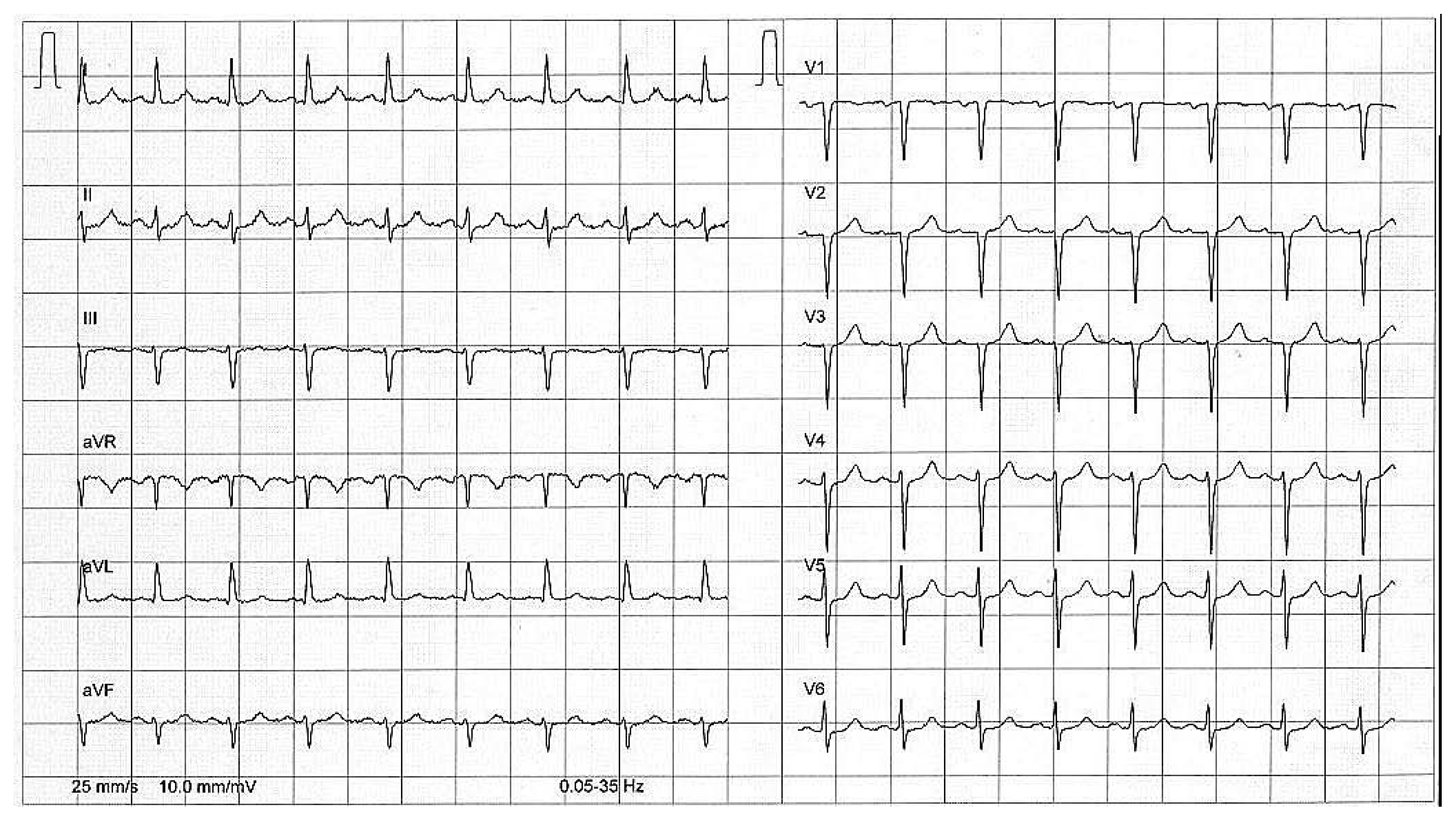 Cardiovascmed 10 00176 g001 Cardiovascmed 10 00176 g001