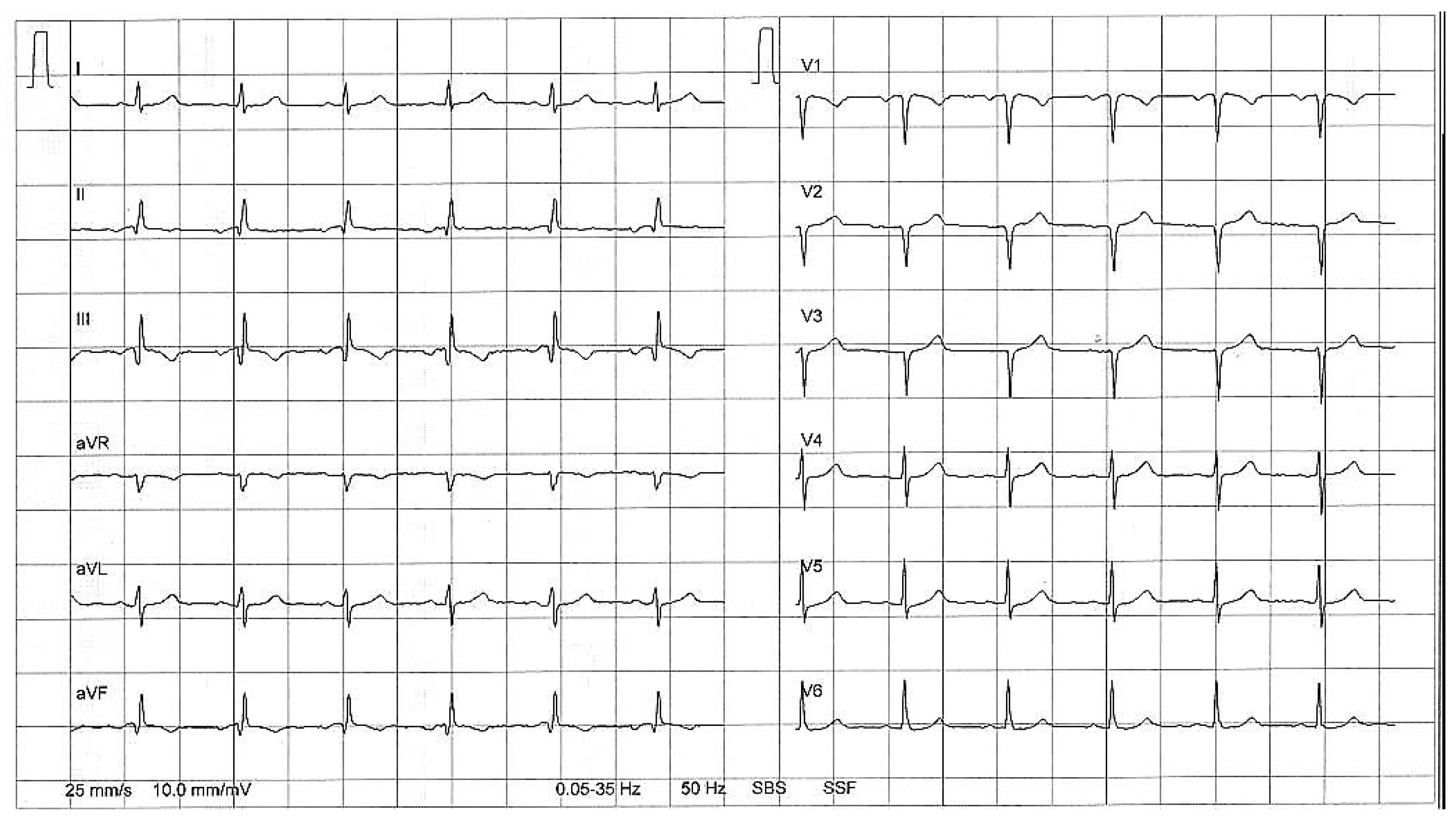 Cardiovascmed 10 00176 g002 Cardiovascmed 10 00176 g002