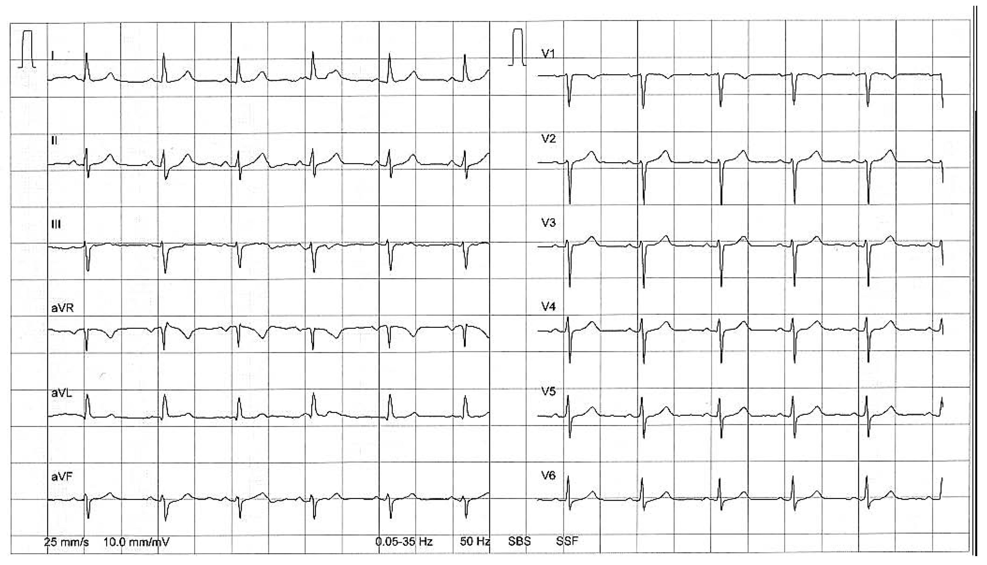 Cardiovascmed 10 00176 g003 Cardiovascmed 10 00176 g003