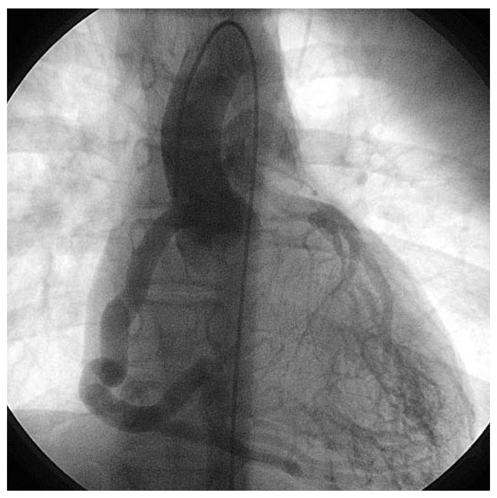 Cardiovascmed 10 00179 g001 Cardiovascmed 10 00179 g001