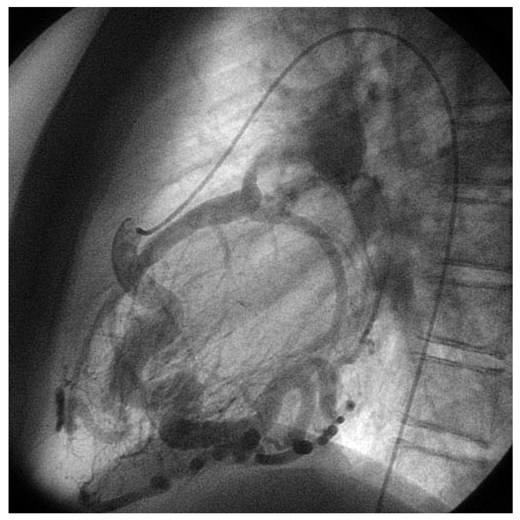 Cardiovascmed 10 00179 g002 Cardiovascmed 10 00179 g002