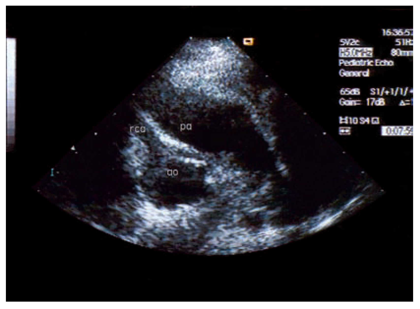 Cardiovascmed 10 00179 g003 Cardiovascmed 10 00179 g003