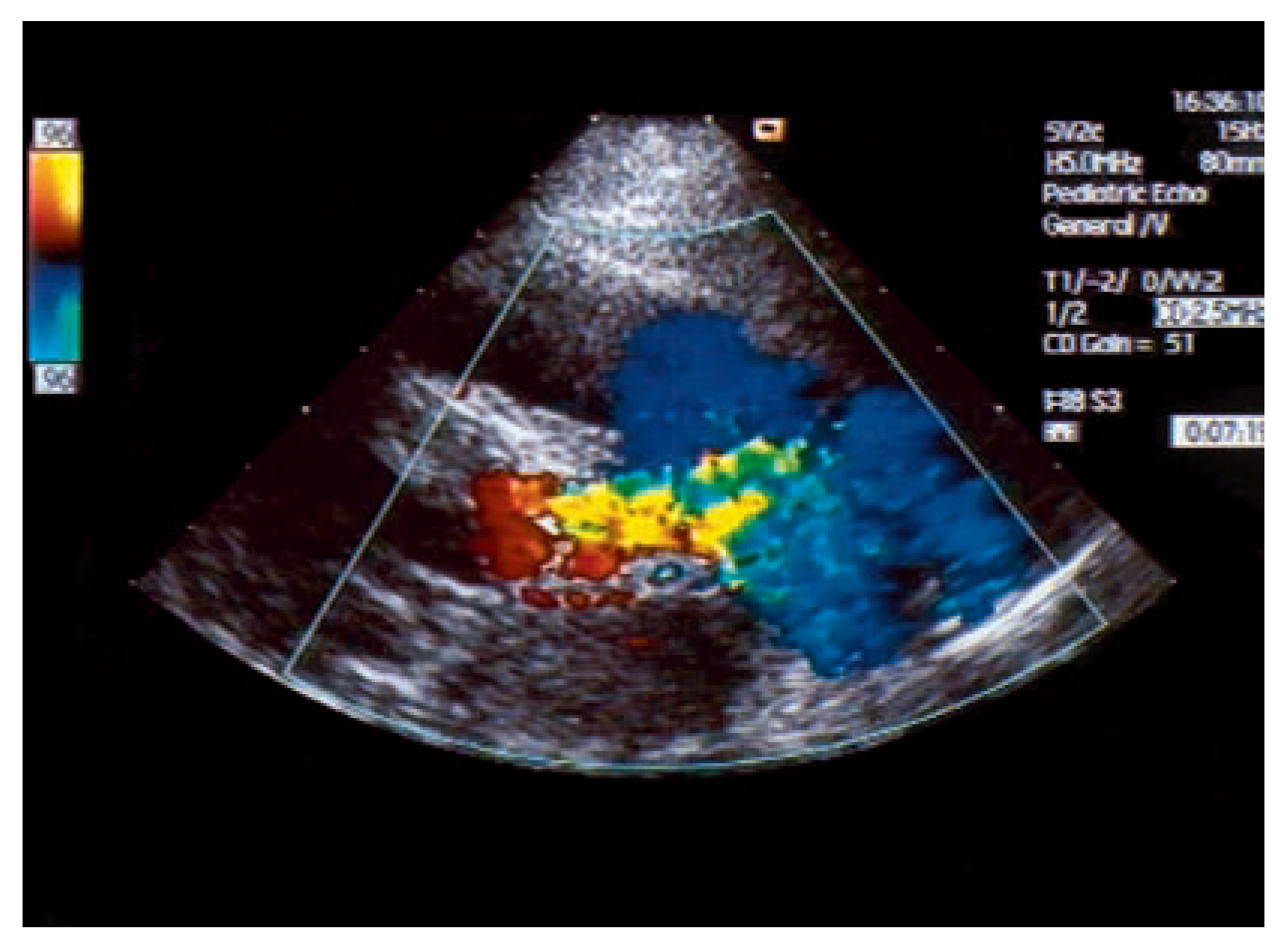 Cardiovascmed 10 00179 g005 Cardiovascmed 10 00179 g005
