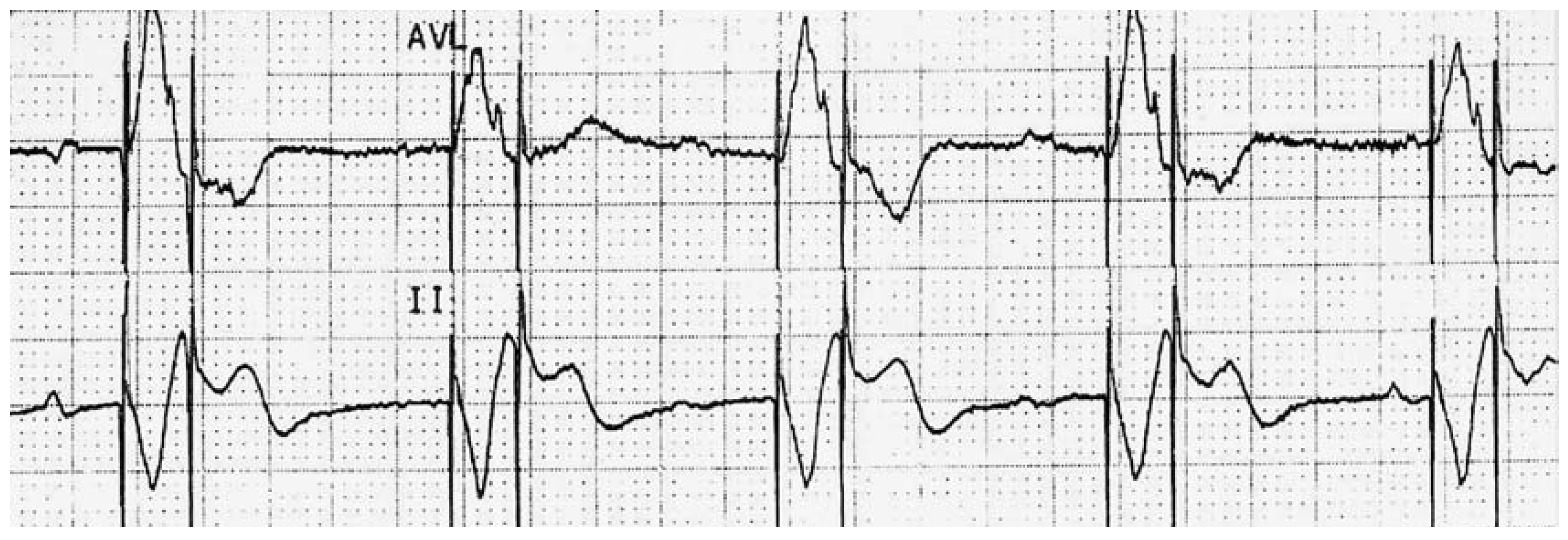 Cardiovascmed 10 00210 g001 Cardiovascmed 10 00210 g001