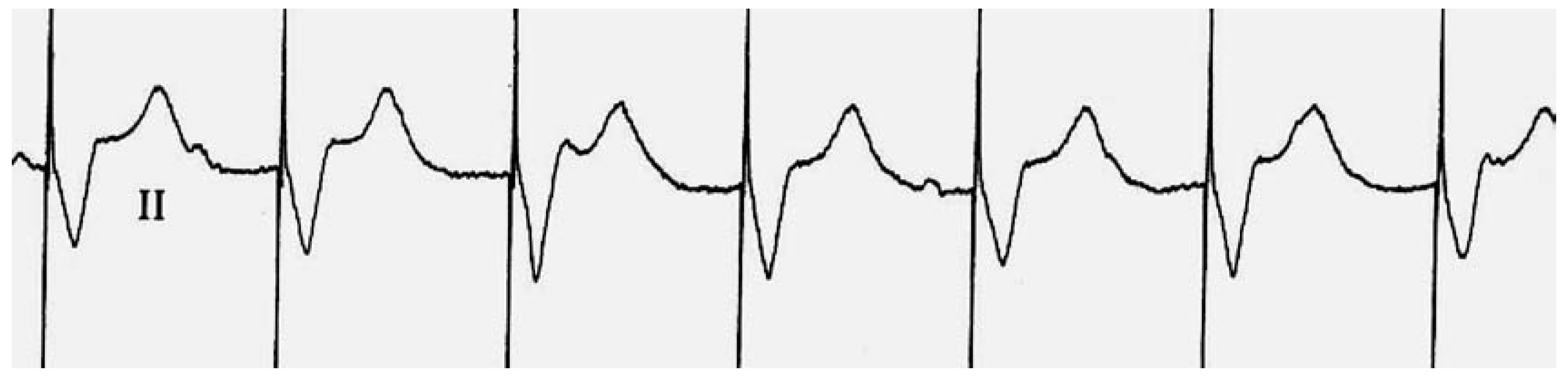 Cardiovascmed 10 00210 g003 Cardiovascmed 10 00210 g003