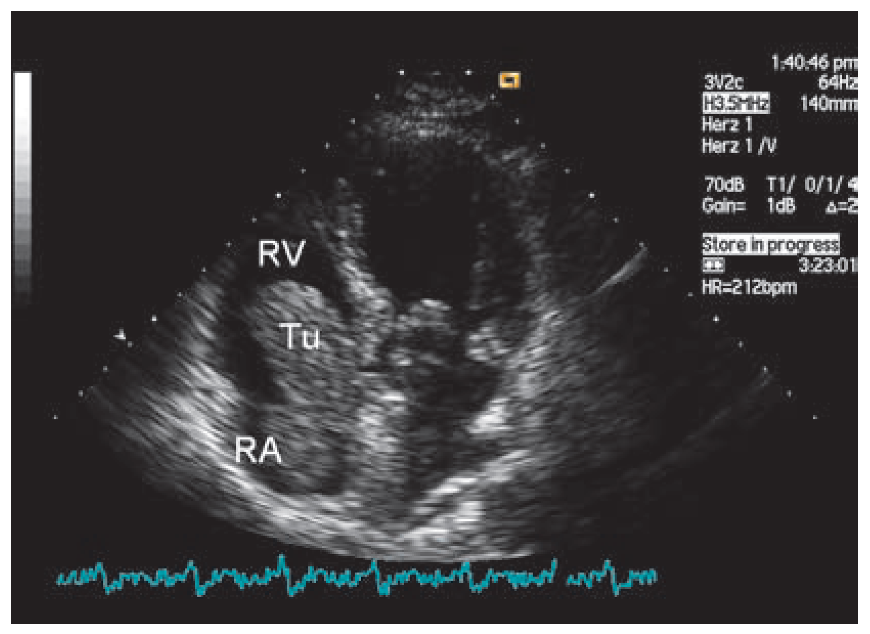 Cardiovascmed 10 00212 g001 Cardiovascmed 10 00212 g001