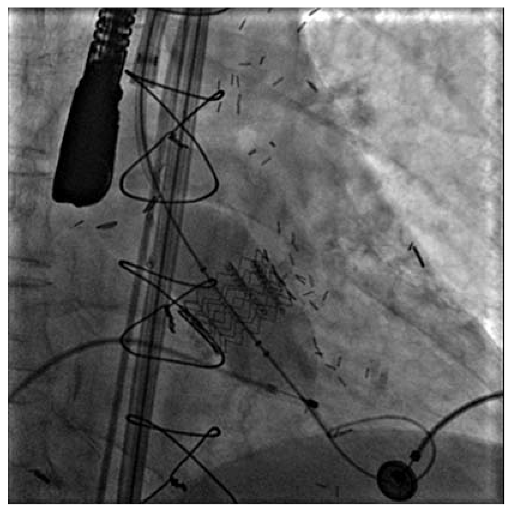 Cardiovascmed 10 00229 g001