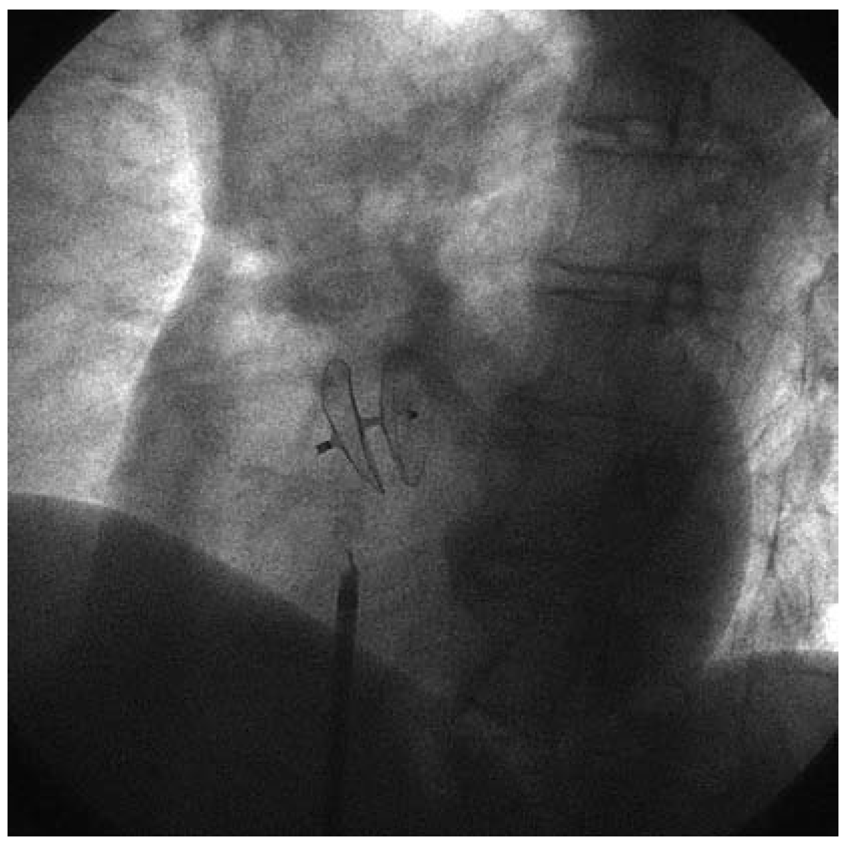 Cardiovascmed 10 00229 g002