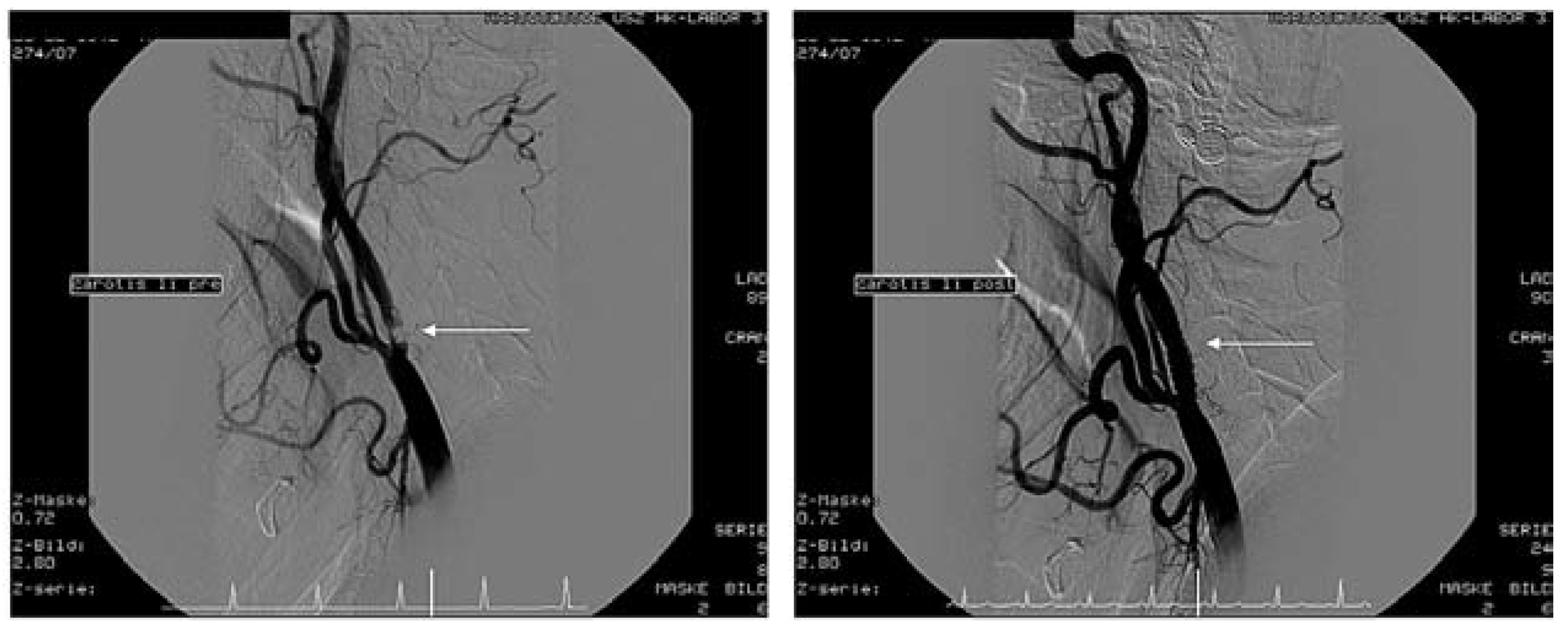 Cardiovascmed 10 00229 g003