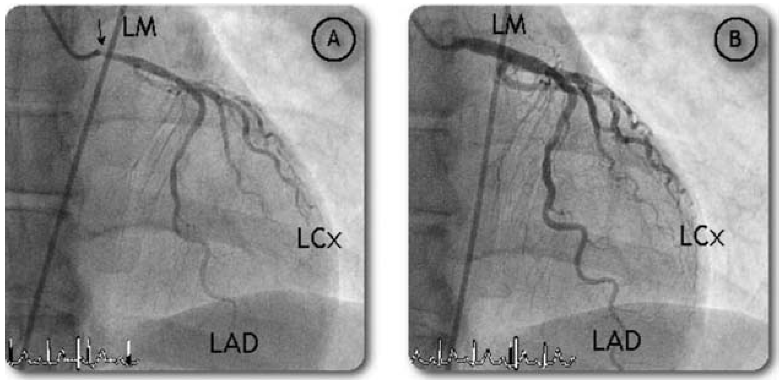 Cardiovascmed 10 00262 g001 Cardiovascmed 10 00262 g001