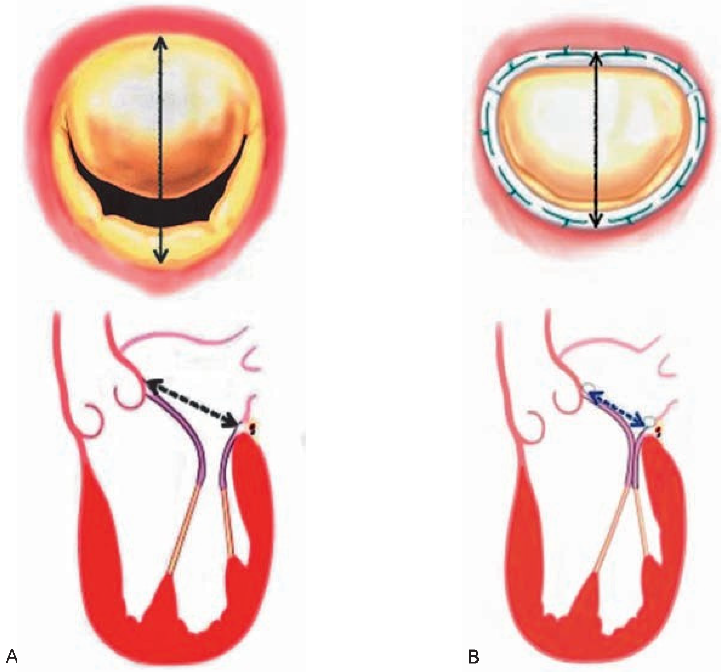 Cardiovascmed 10 00271 g003