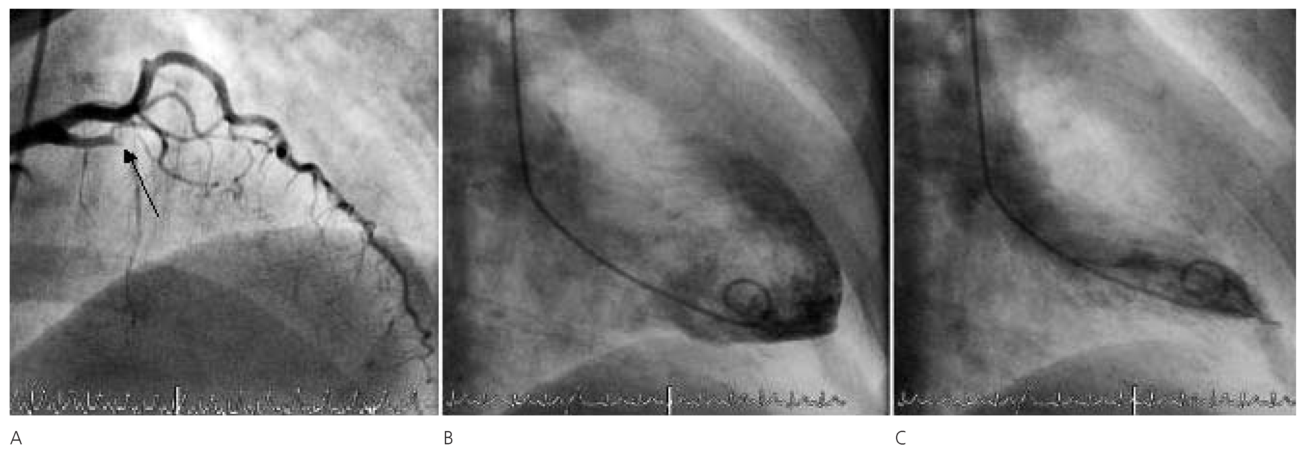 Cardiovascmed 10 00298 g001 Cardiovascmed 10 00298 g001
