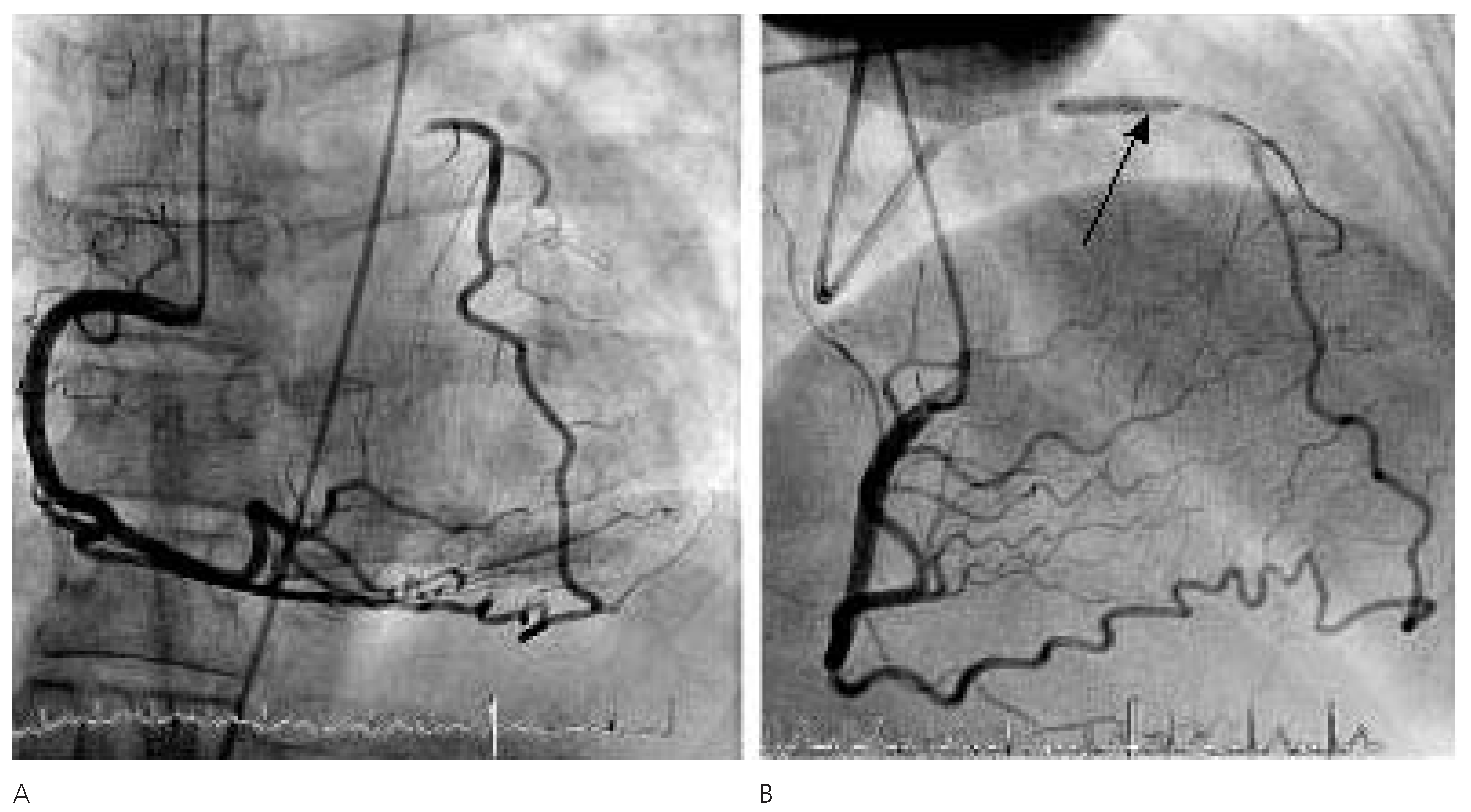 Cardiovascmed 10 00298 g002 Cardiovascmed 10 00298 g002