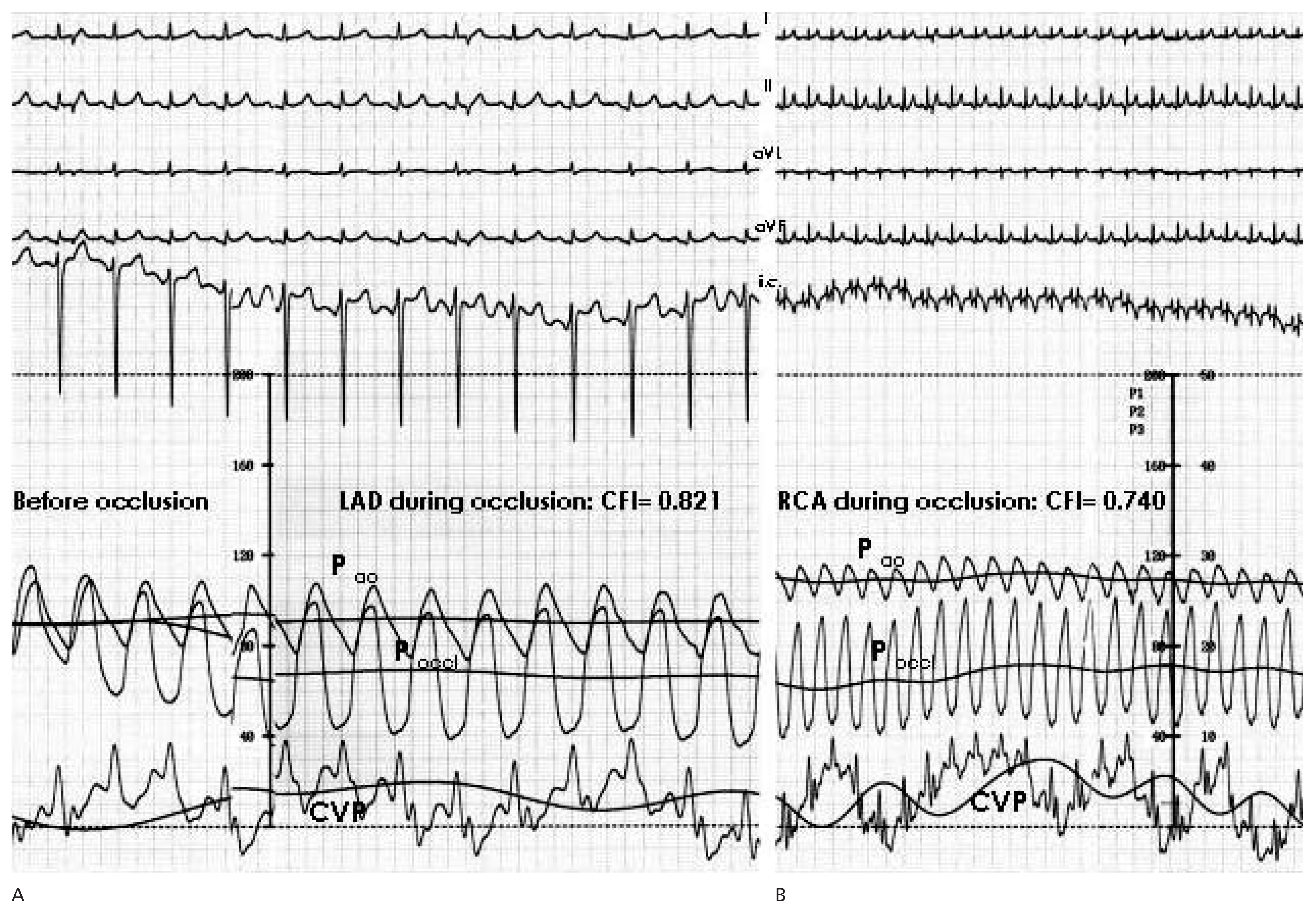 Cardiovascmed 10 00298 g003 Cardiovascmed 10 00298 g003